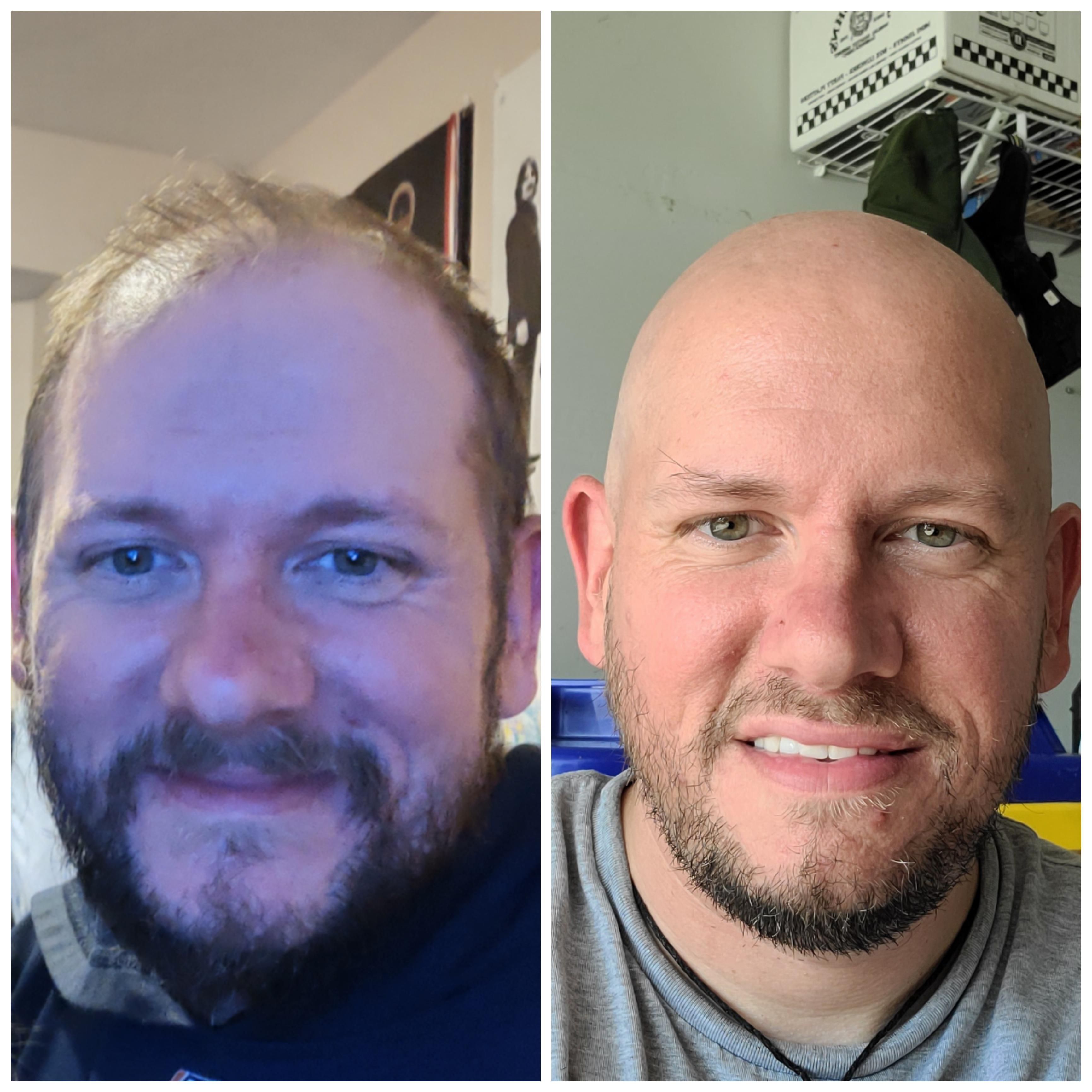 9 months going since I first shaved it all. Realized I don't think I