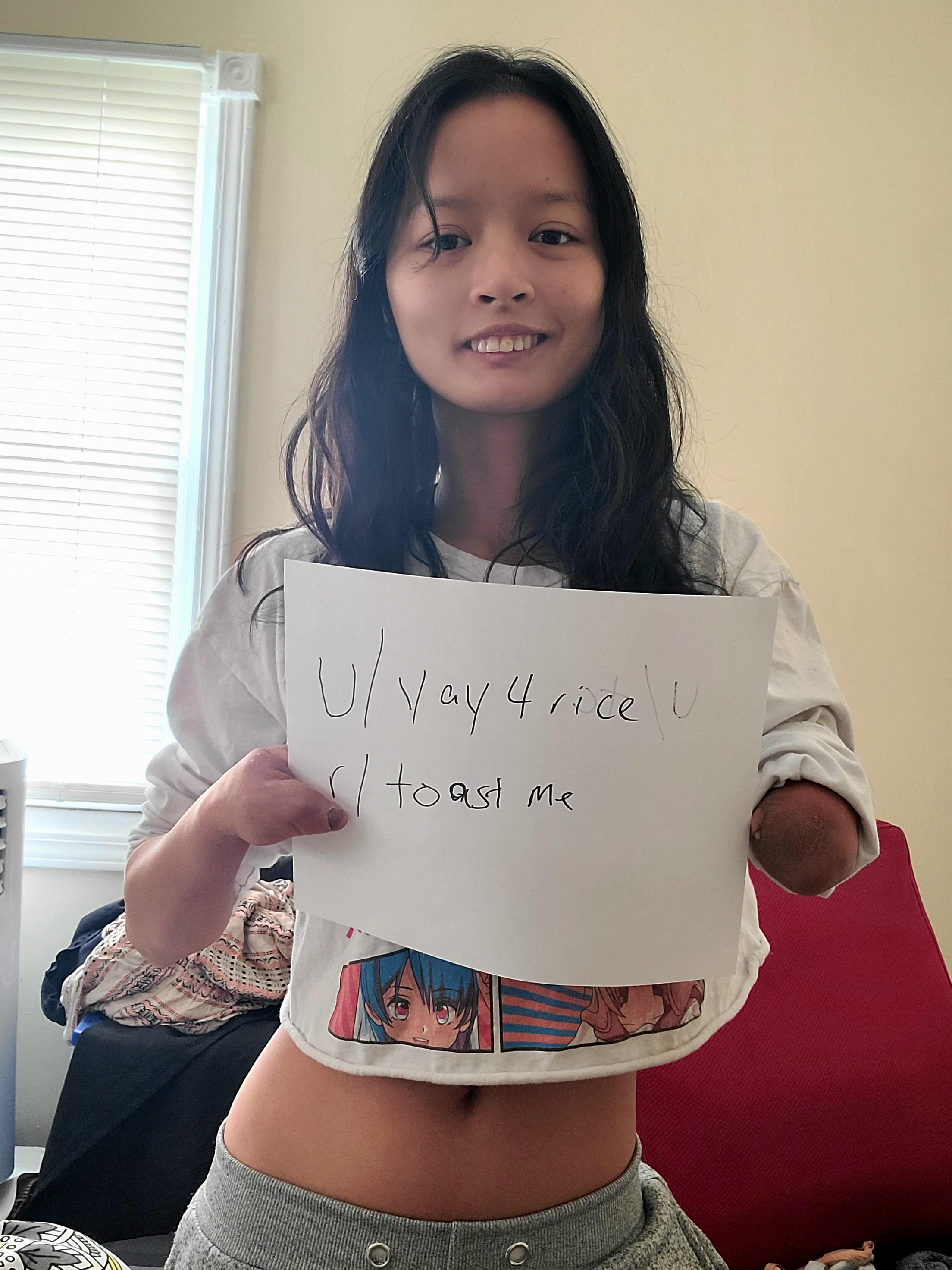 Hi, I was born with congenital abnormalities caused by Agent Orange. I