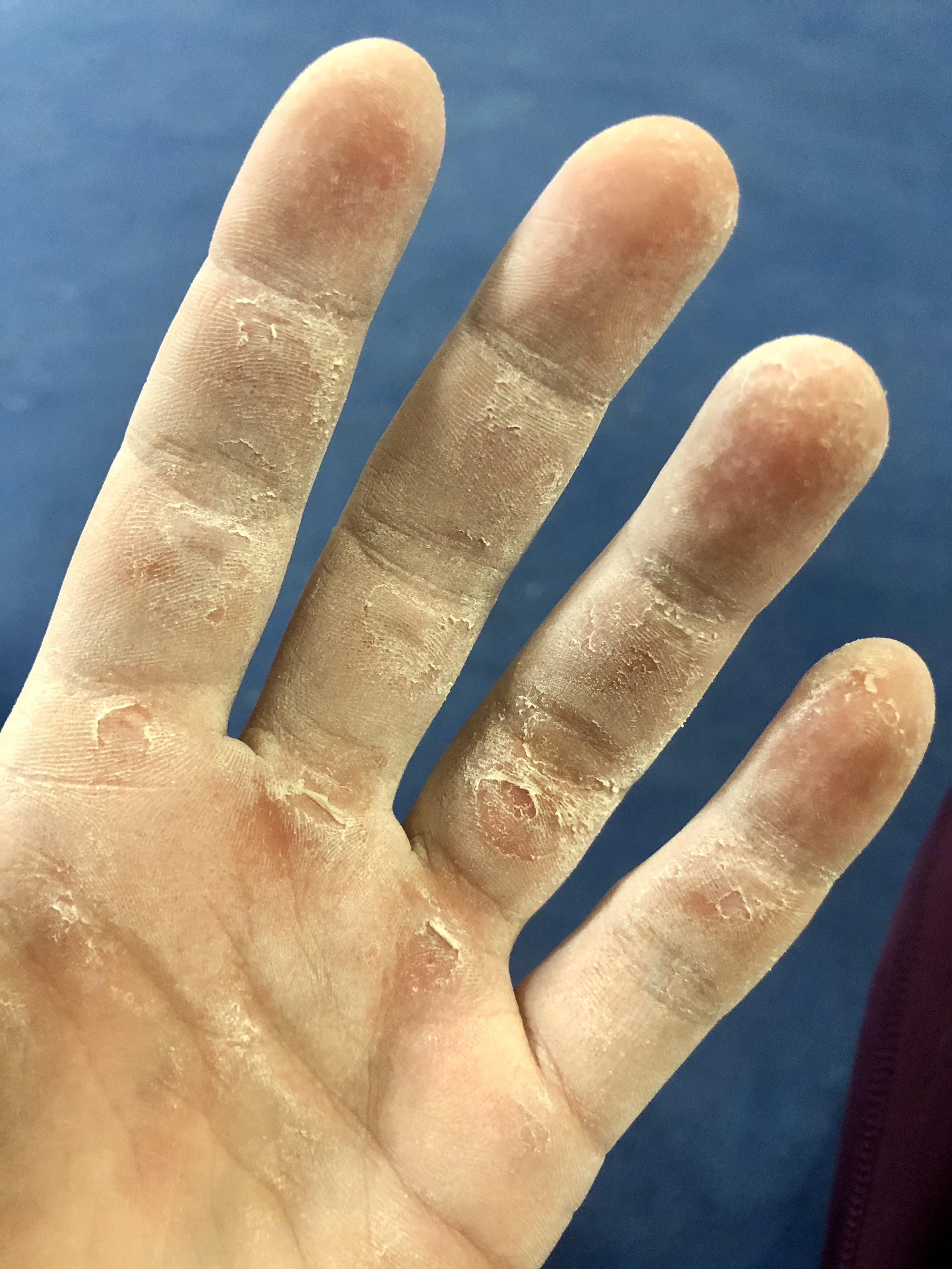 Ugly Hand Pride r/climbergirls