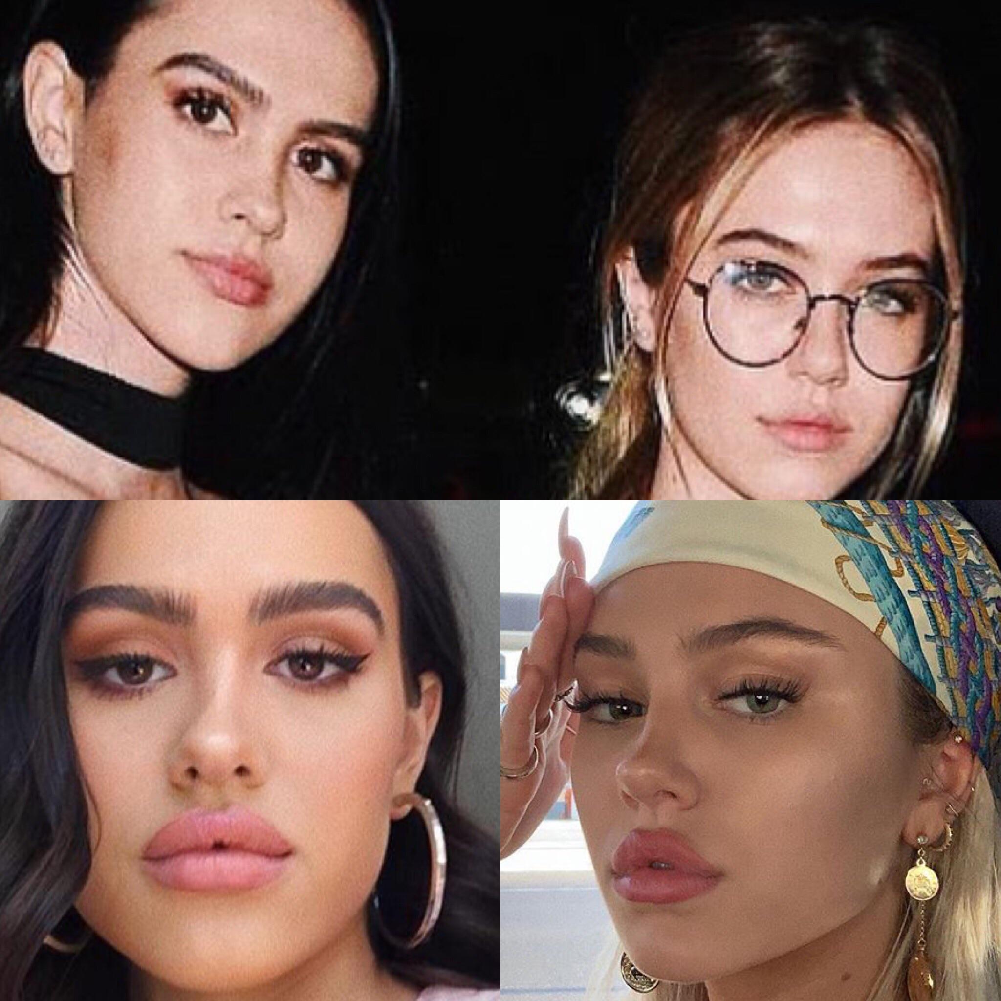 The inflated lip trend....both girls had full lips to begin with, but