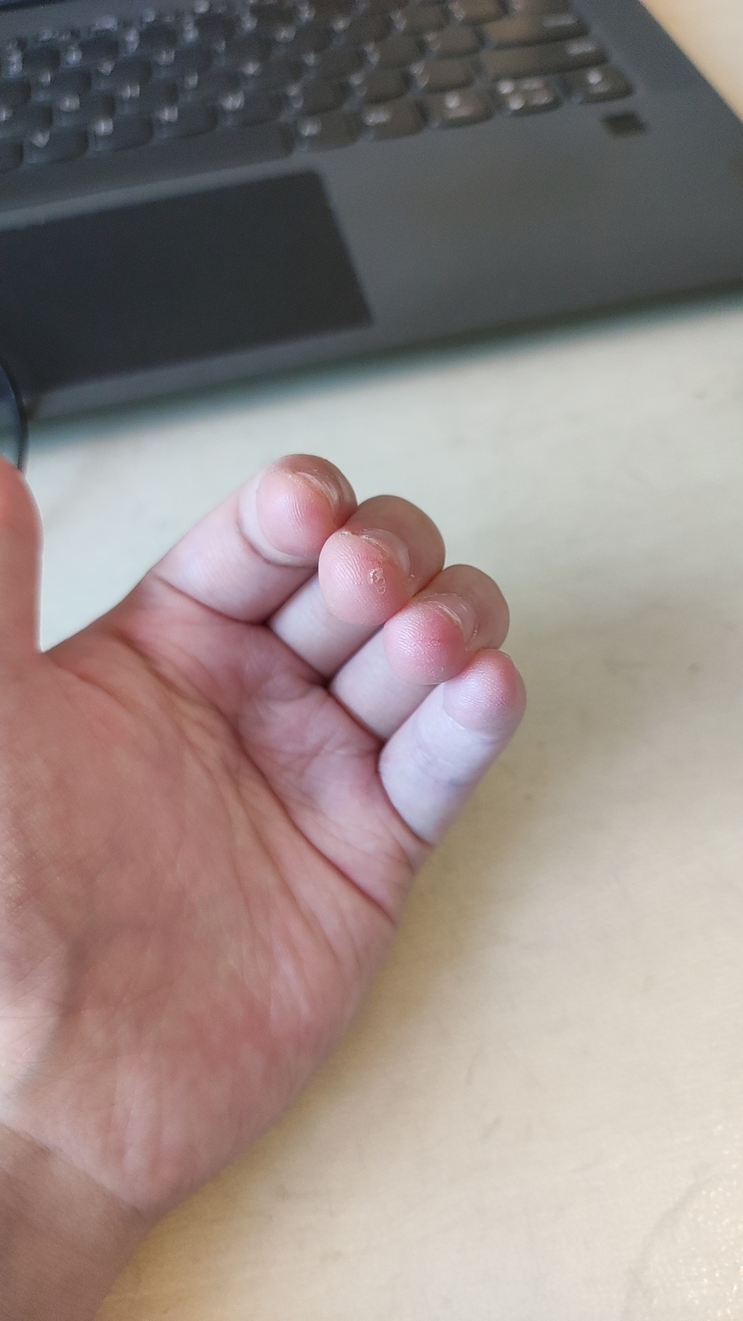 Dear violin gang, does the fact that only my middle finger is