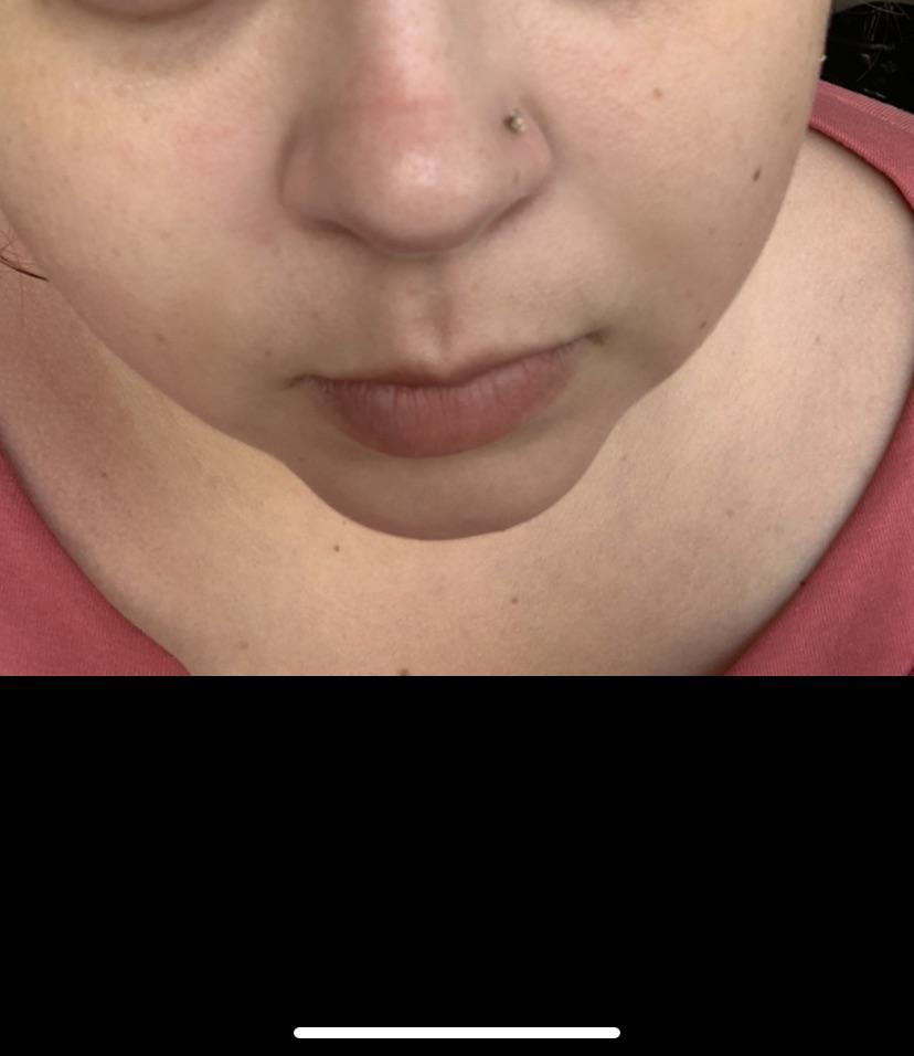 Line on nose. Any suggestions? I don’t know if this was from creasing