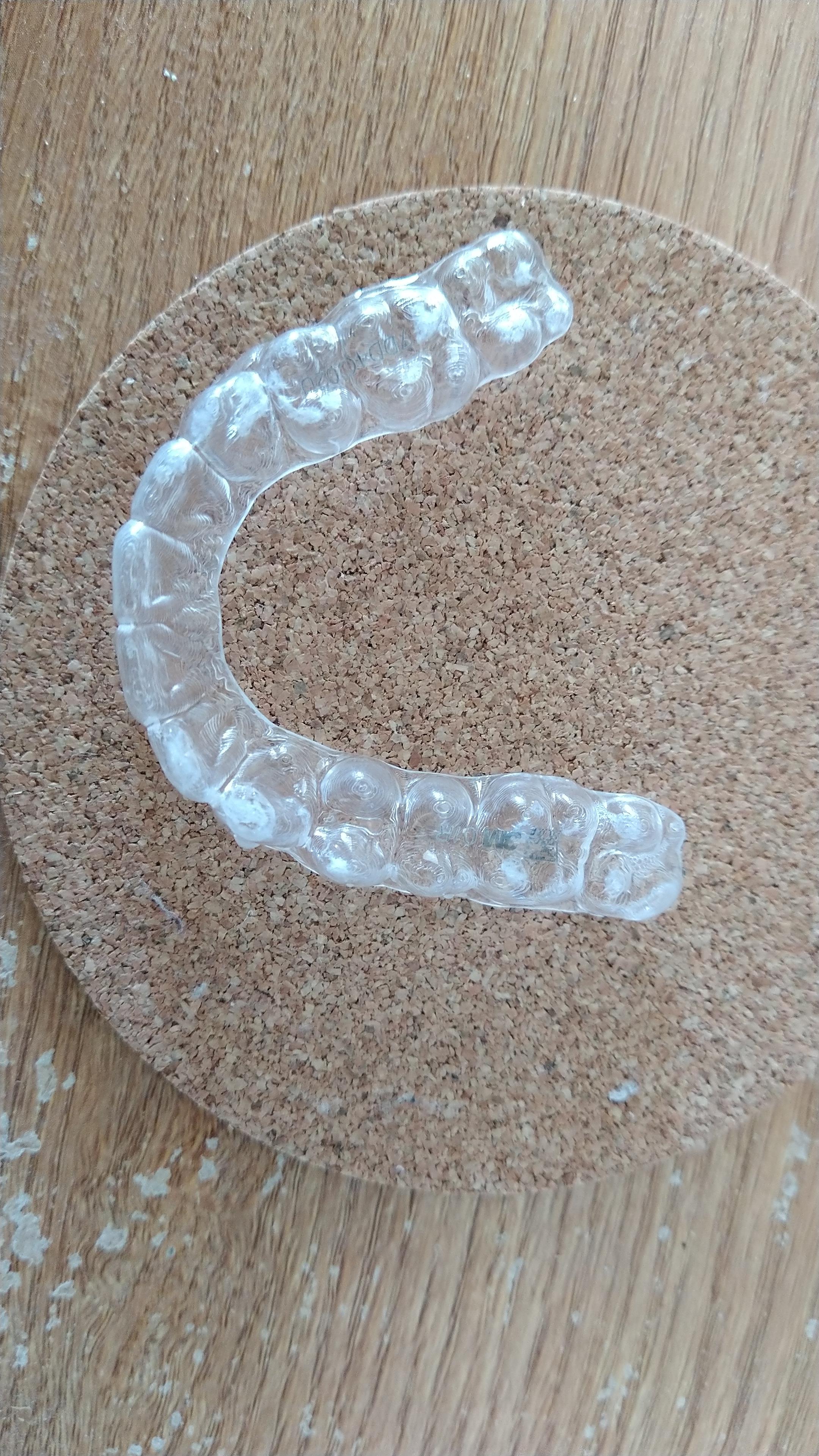 What is this white stuff on my retainers and how do I get them off? r