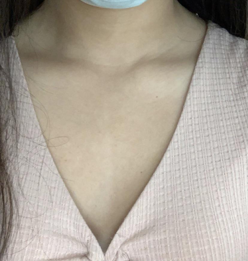 What is the white line going down my chest? r/medical_advice
