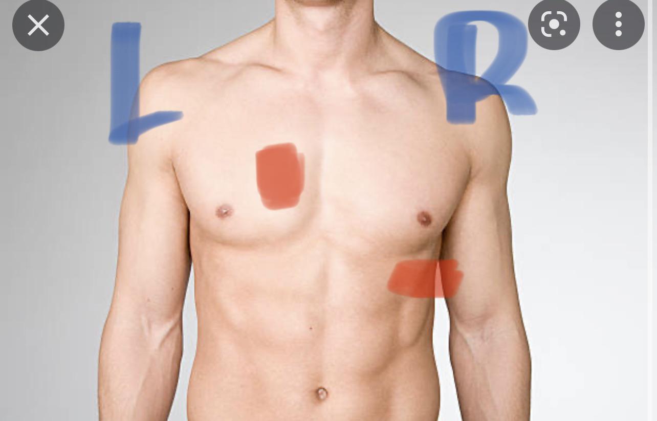 Just had a pain attack next to my left breast. Touched the area and it