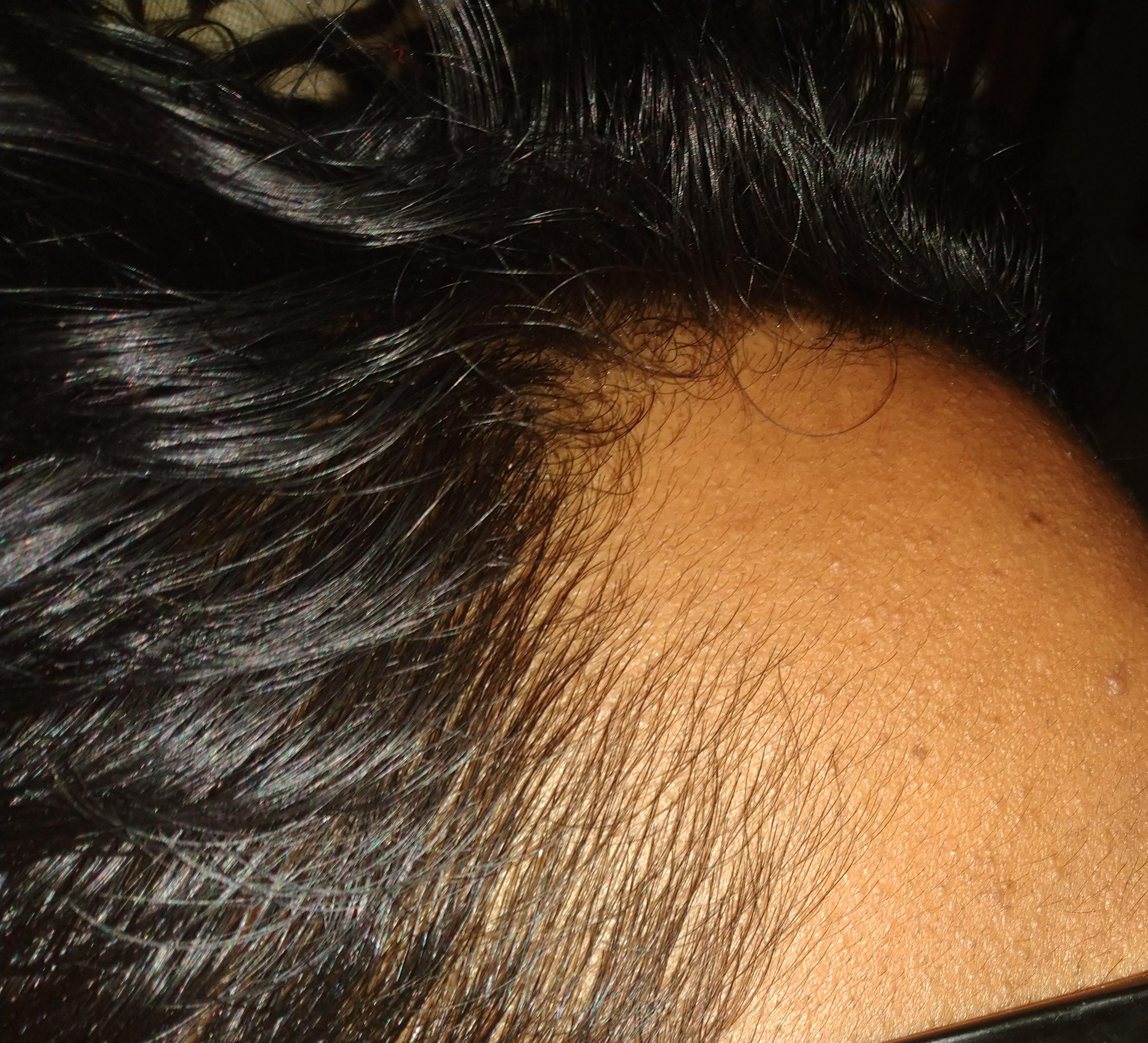 Is this regrowth?(zoomin to see the baby/vellus hair growing on side