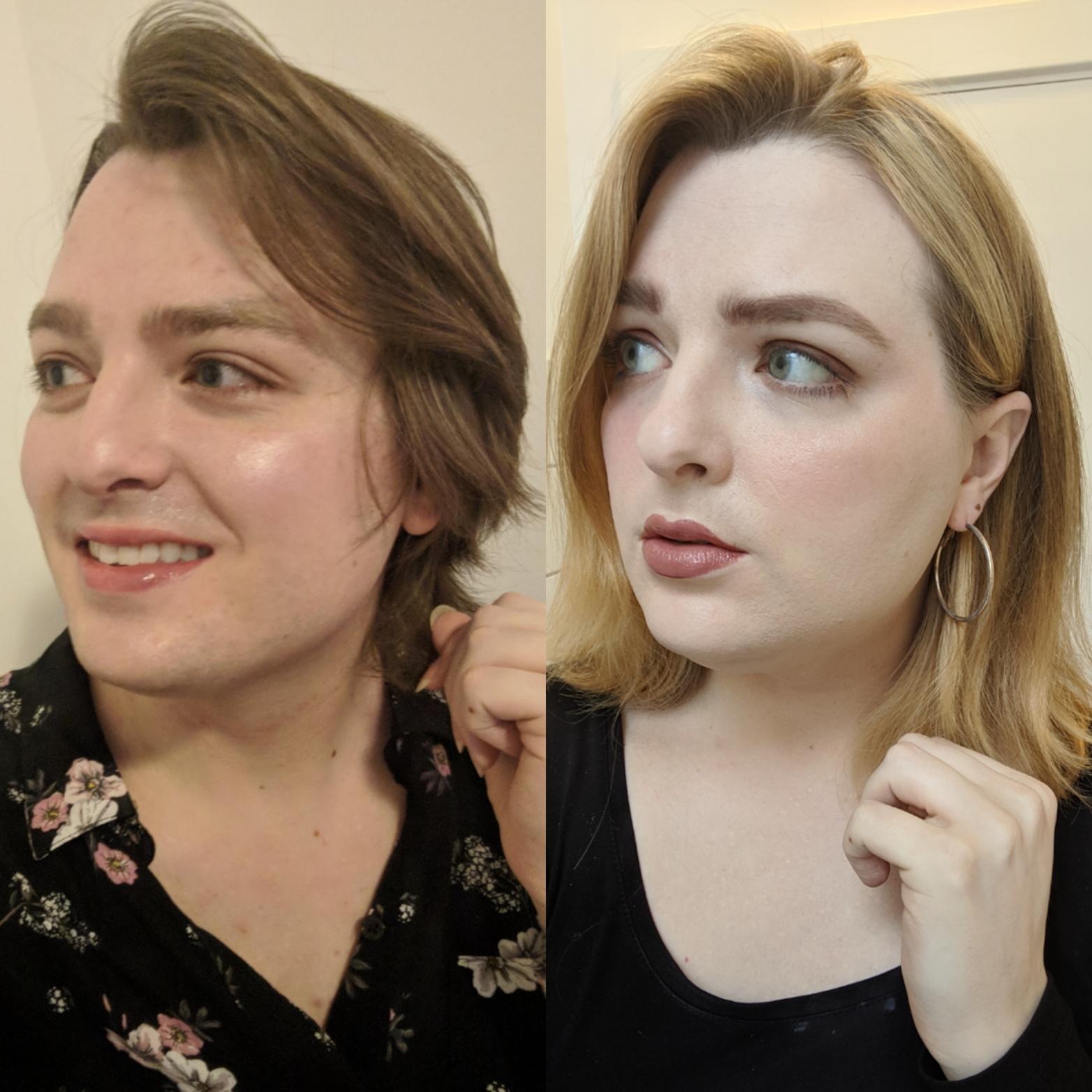 33 MTF, 14 mos HRT. Photos exactly a year apart r/transtimelines
