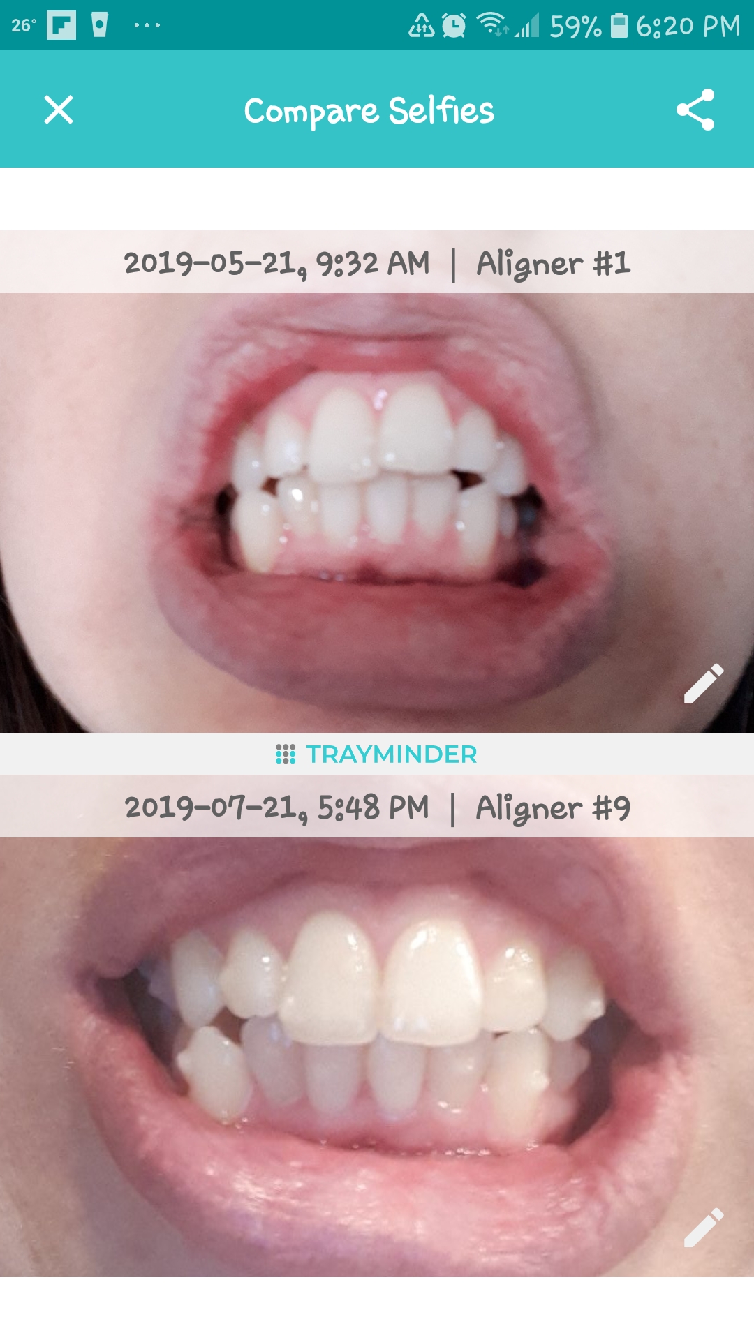 Seeing up close pictures of my teeth is kind of gross to