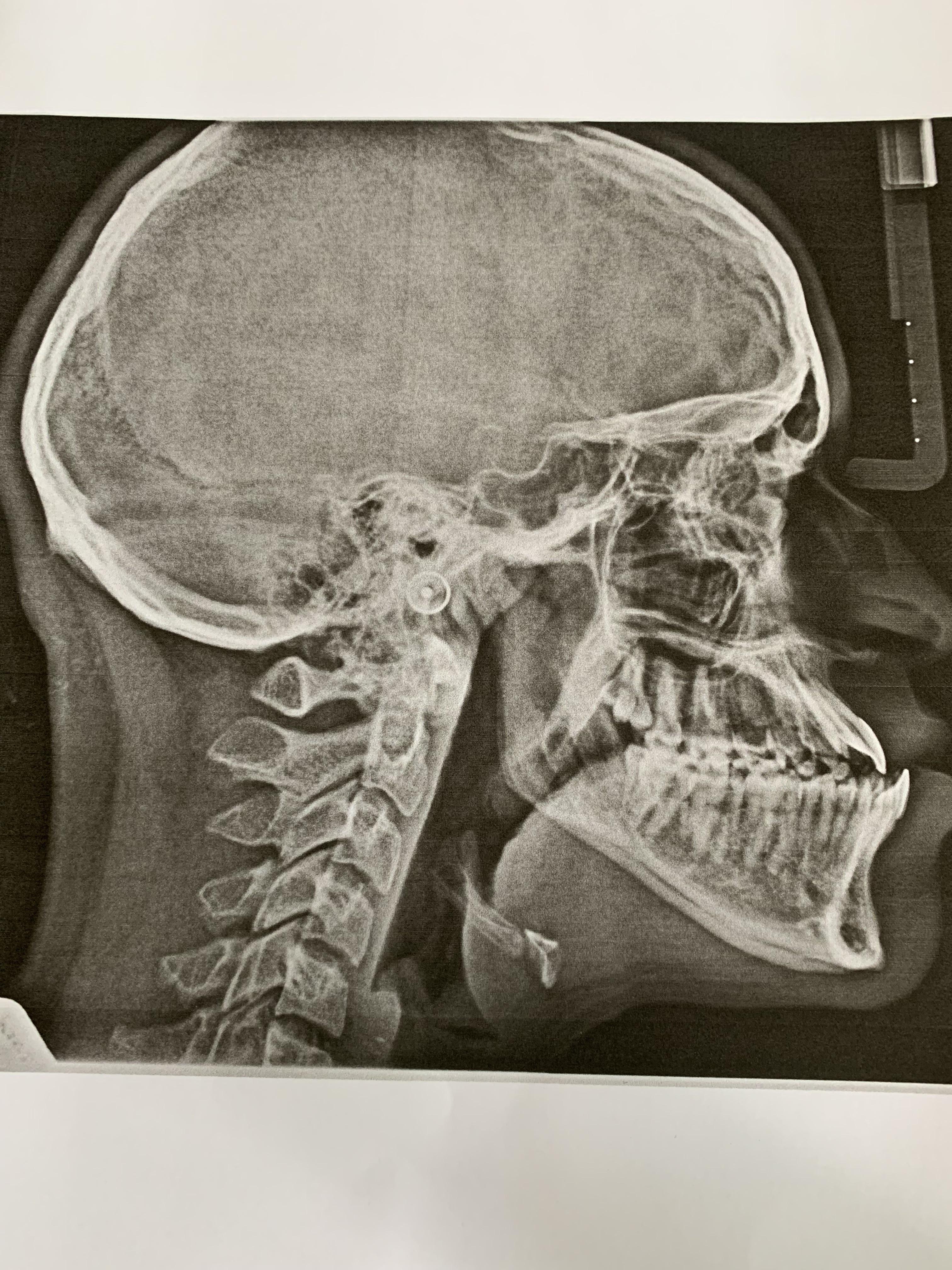 overview for dentalhydroplosion