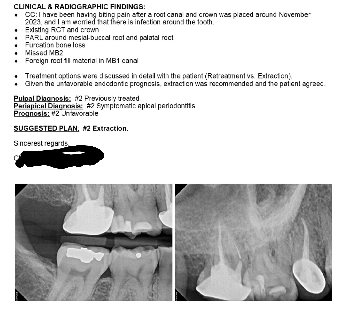 Lost in Las Vegas; Failed root canal and tooth extraction 2 in Las