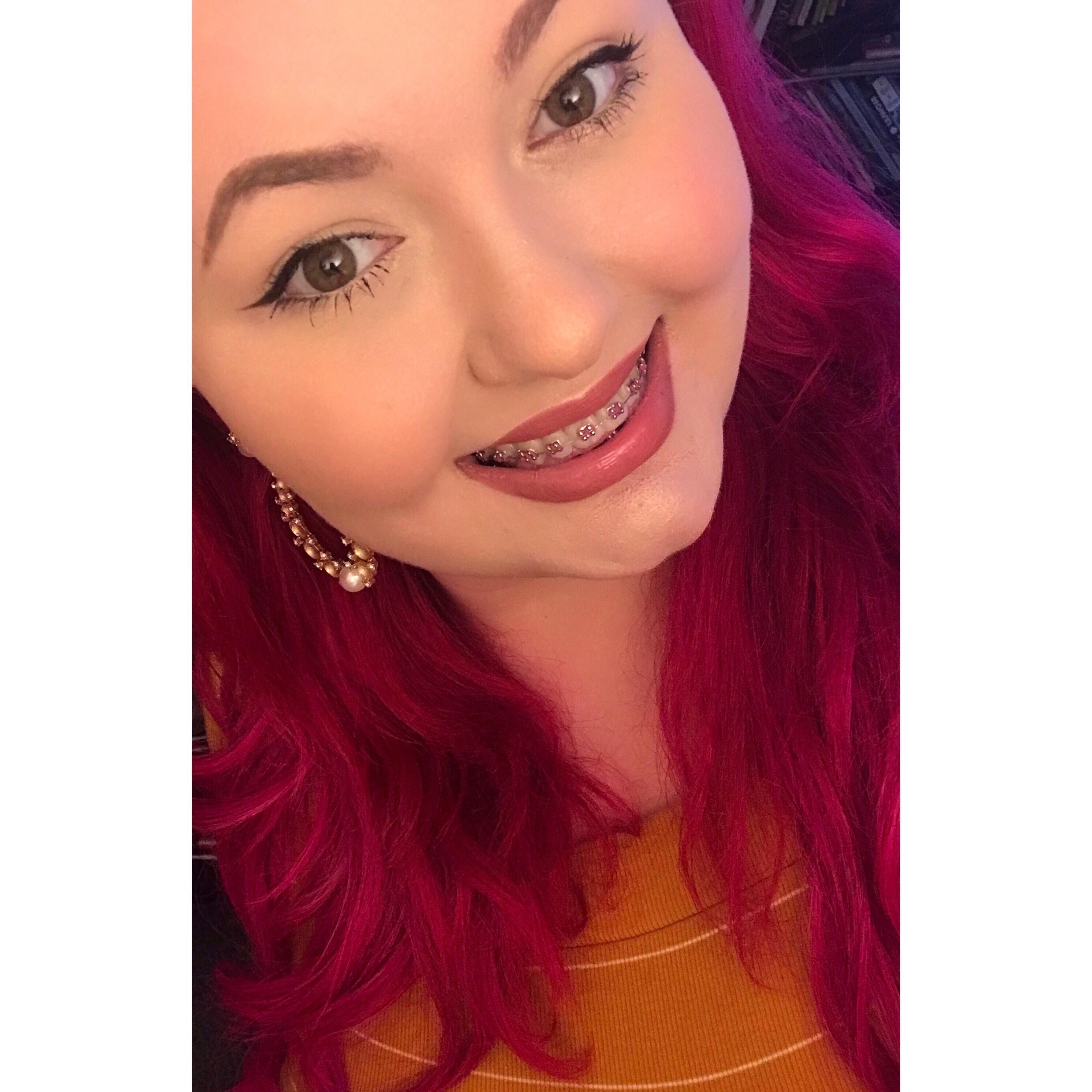 pink braces to match pink hair! 80 days into treatment r/braces