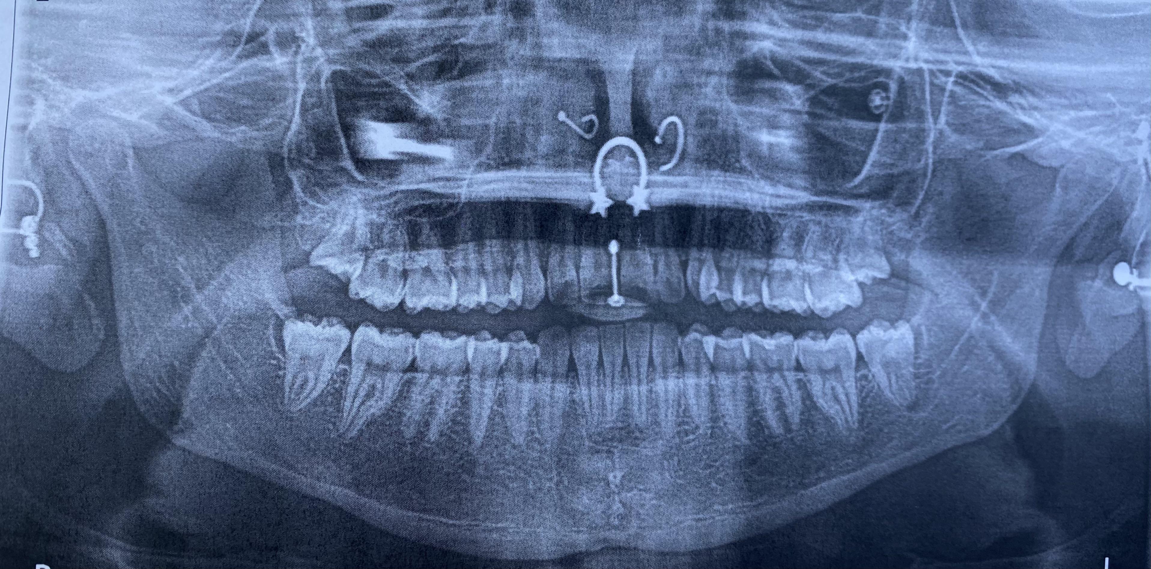 getting an x ray at the dentist’s never fails to make me feel like a