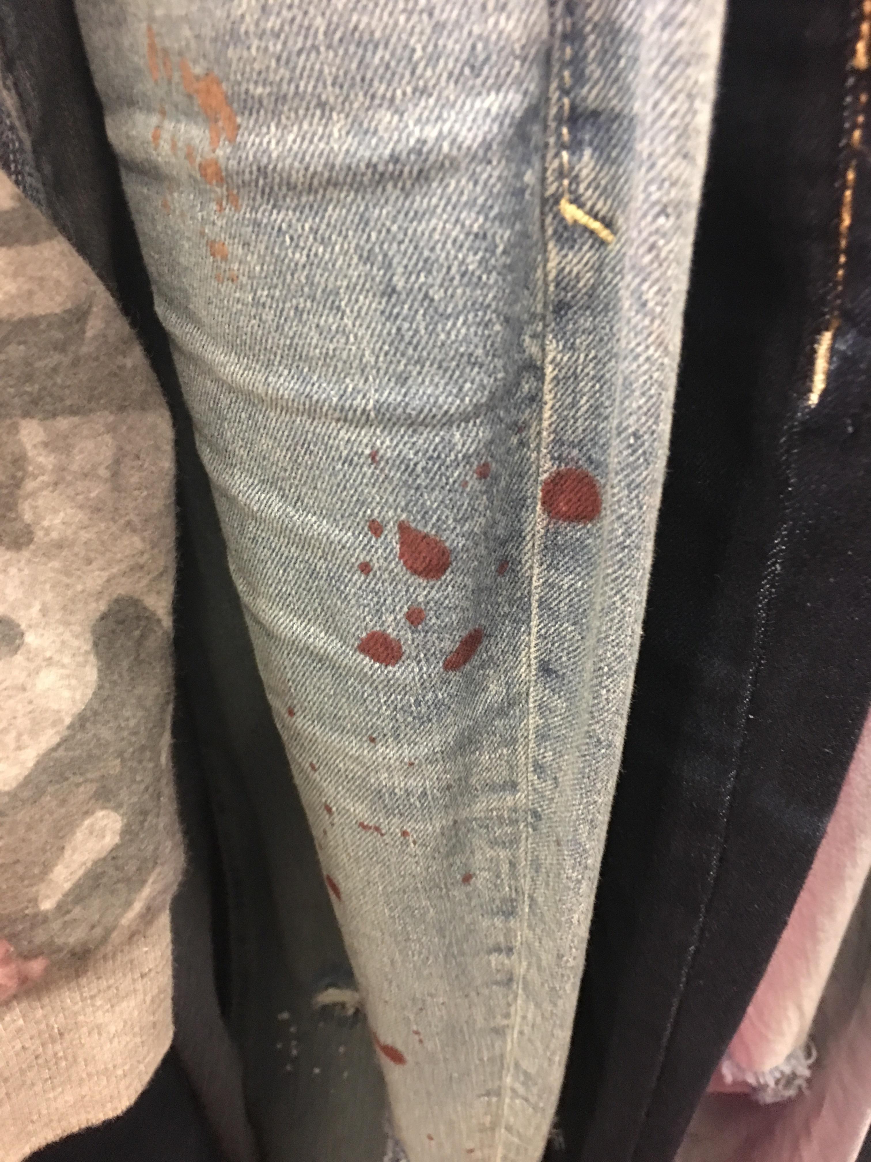 These red and brown spots are actually a pants design r/CrappyDesign