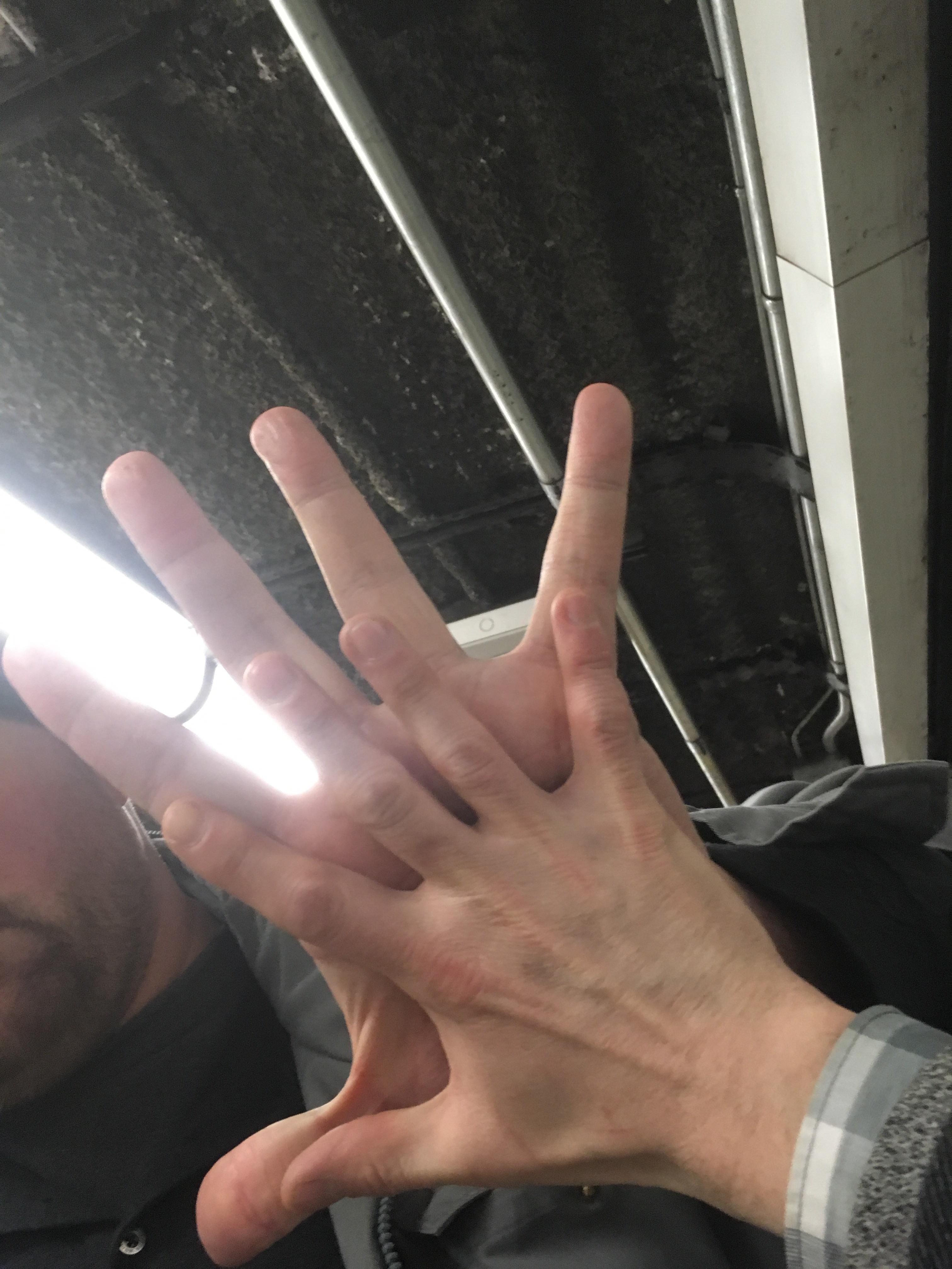 Smallest Hands In The World