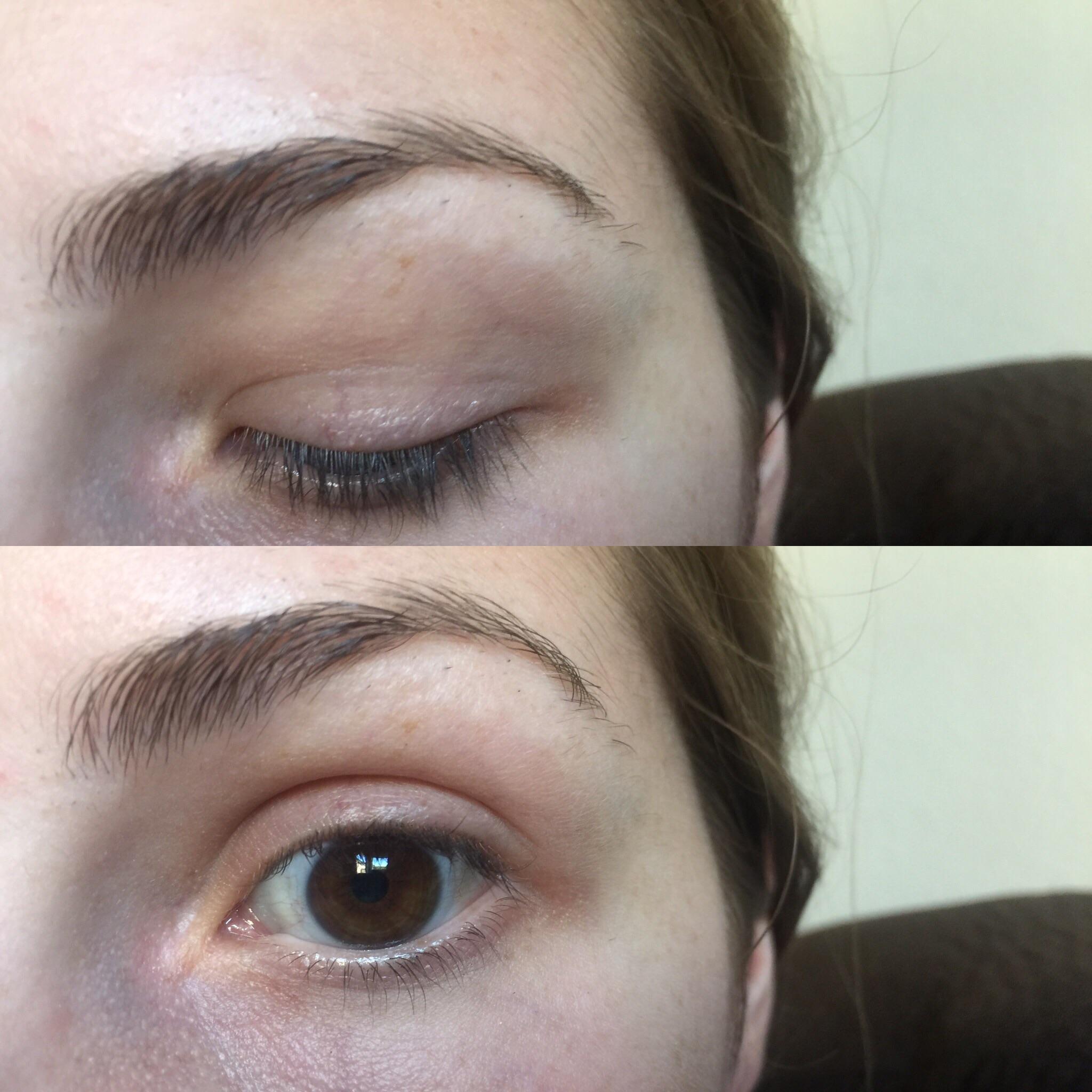 [Skin Concerns] Need help with dark coloring on outer corner of eyes