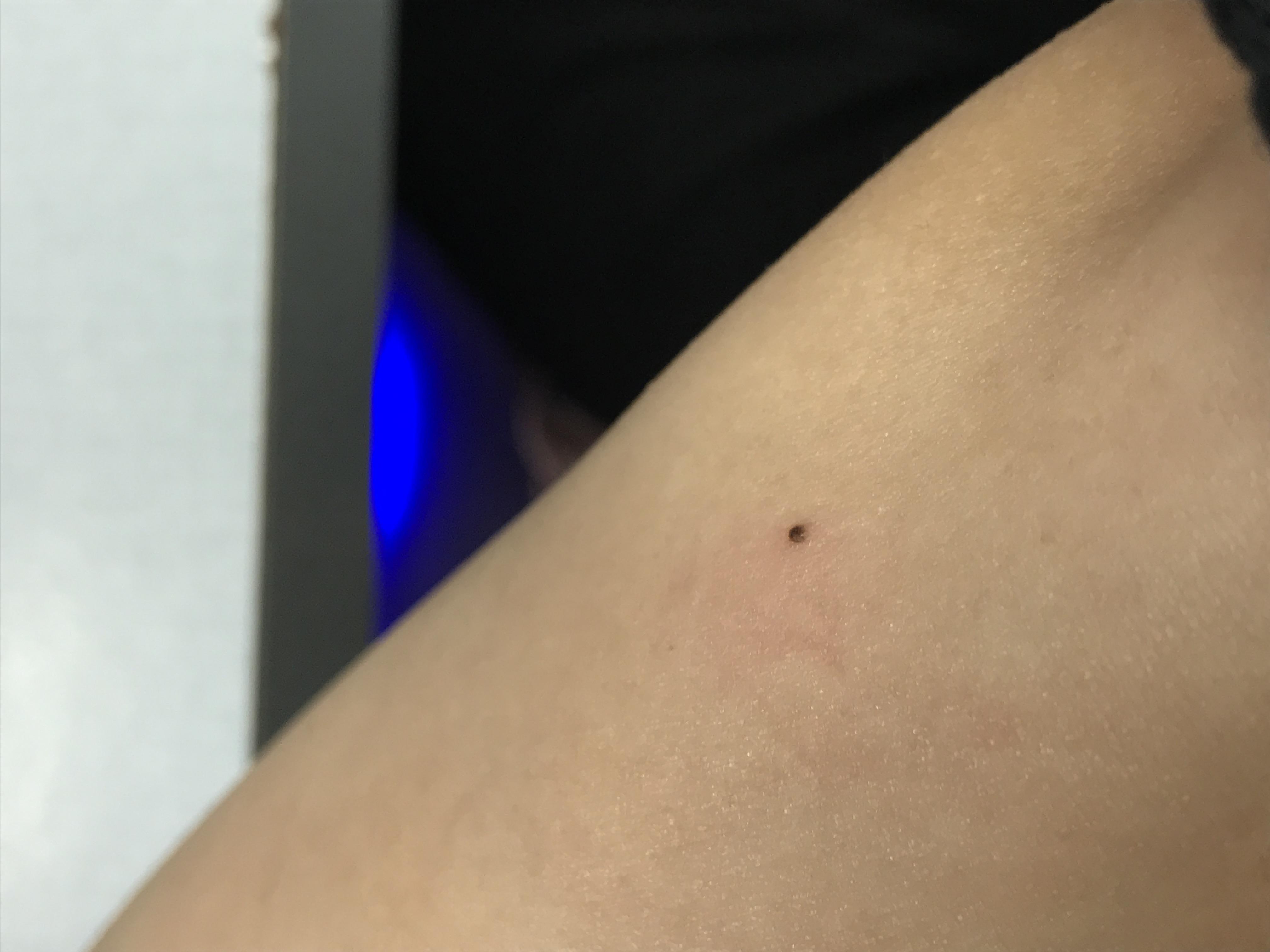 Dark Mole.Found this mole this morning, I’m not sure if it’s always