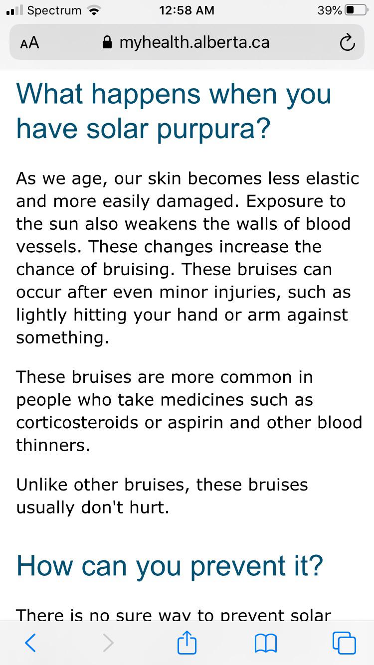 What Does Solar Purpura Look Like / Chronic Skin Fragility Of Aging