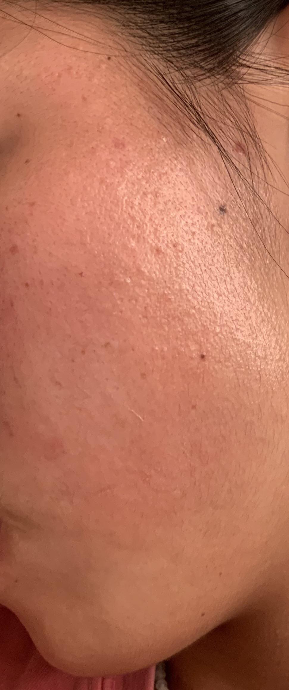 Is moisturizer barrier damaged or is this because I mixed tret with