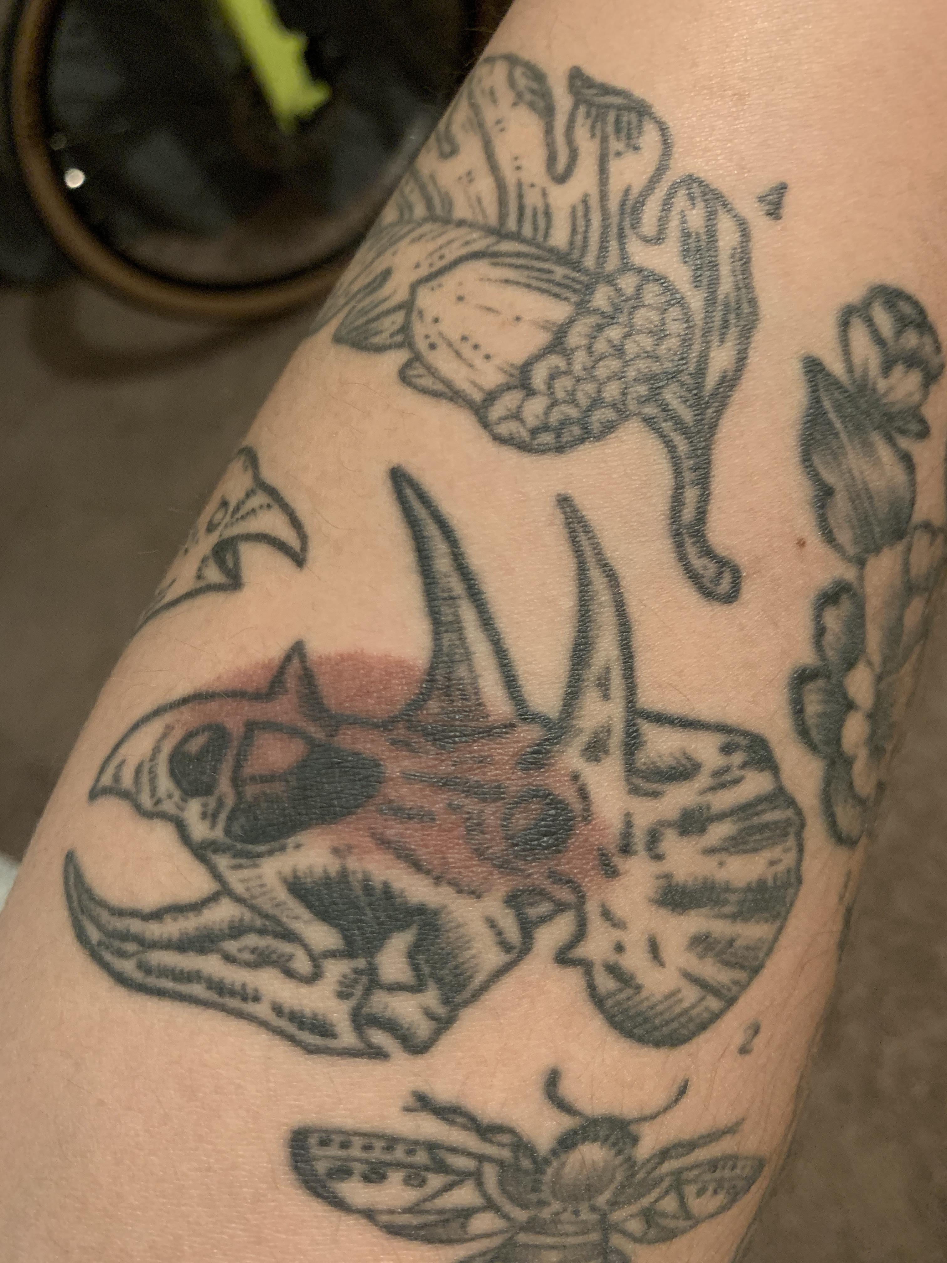 Has anyone burned themselves over their tattoo? Did it damage the ink