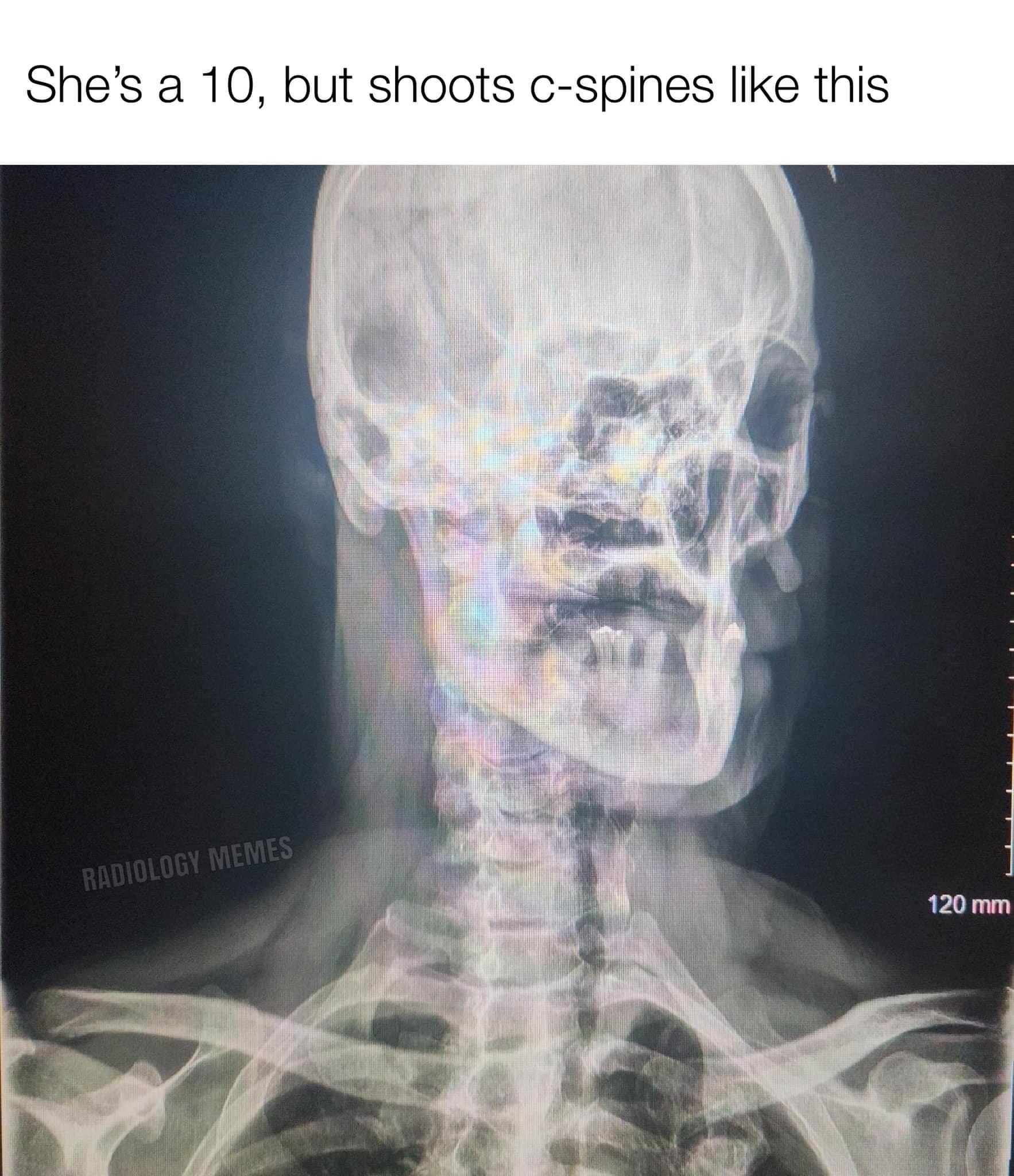 Shame r/Radiology_memes