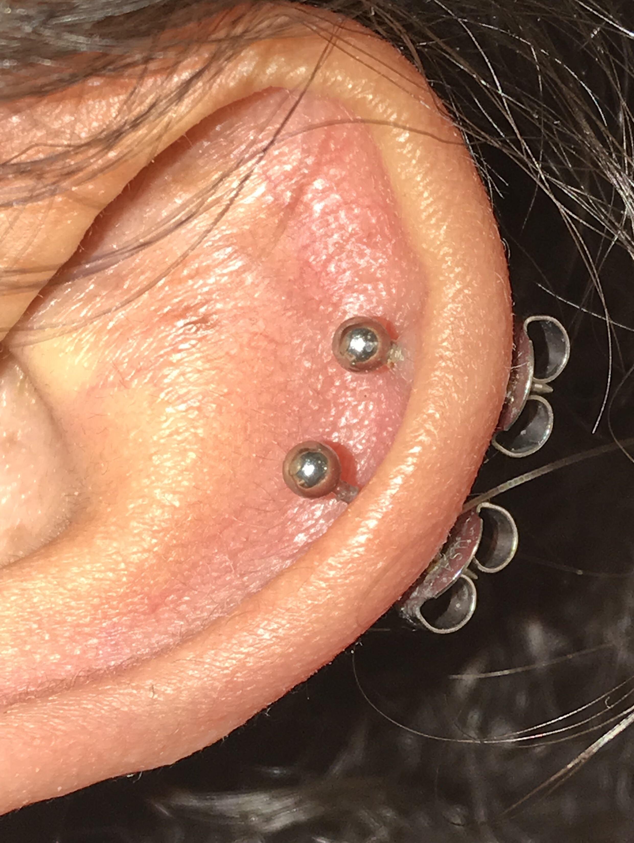 Help! Starting to develop a small bump on my top cartilage piercing and