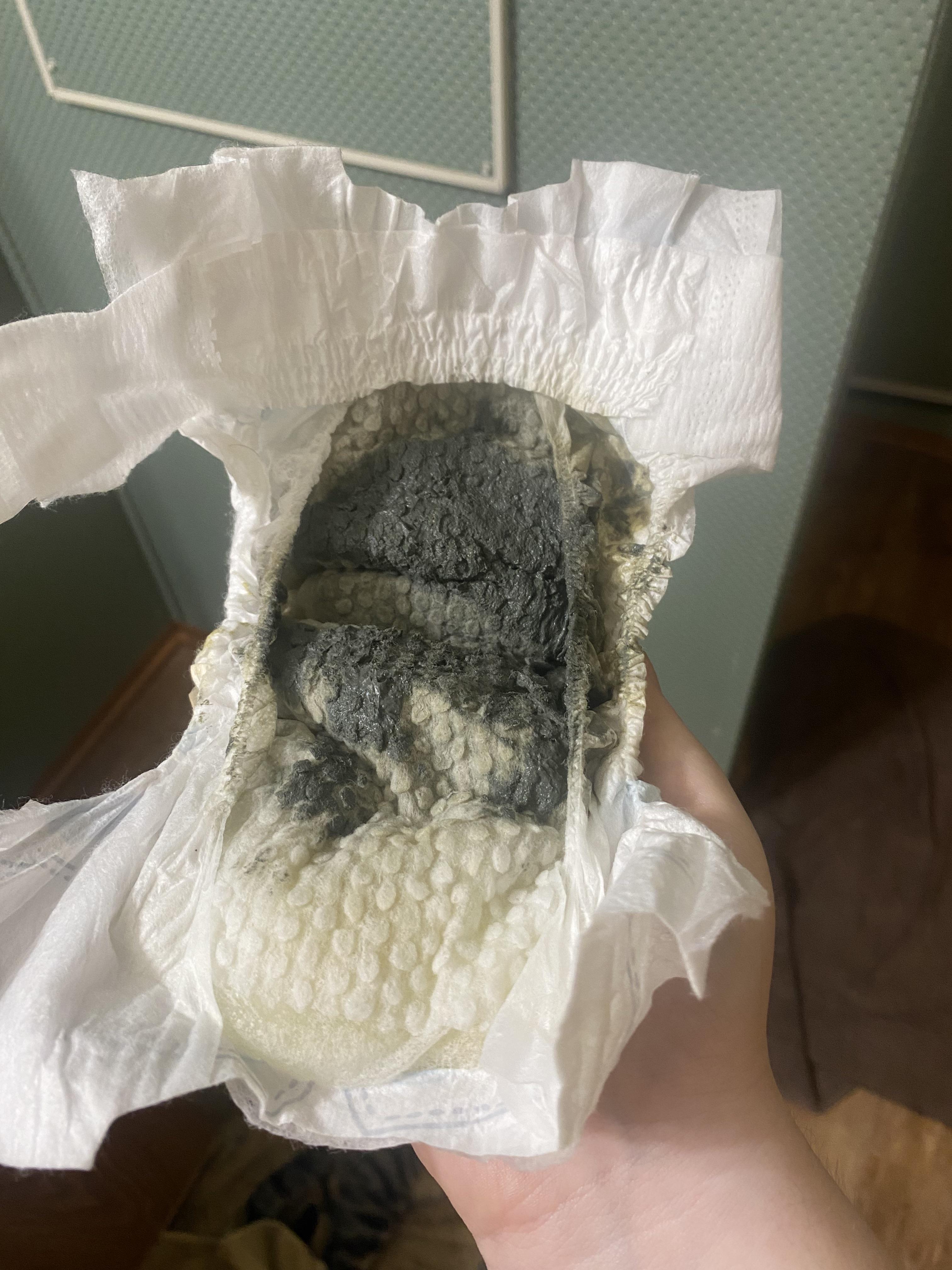 WARNING picture of poppy diaper! Does this poop color look normal? she