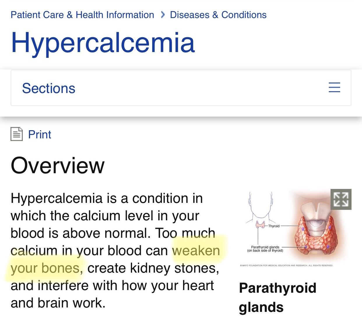 Vitamin D Kidney Stones Reddit