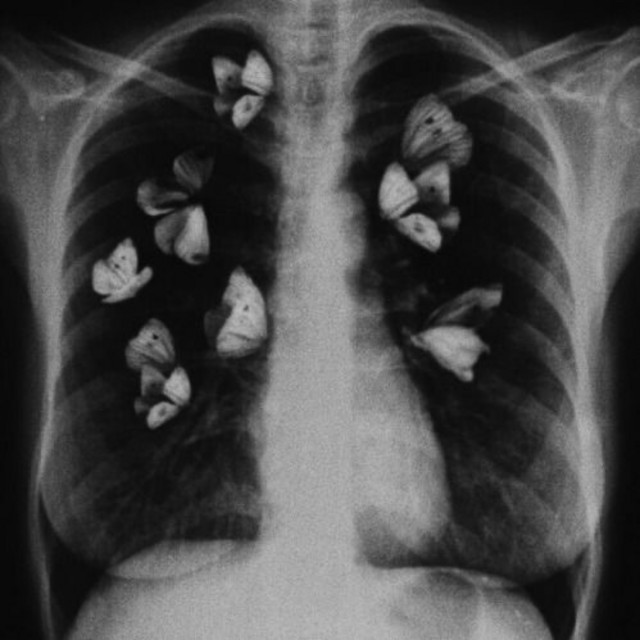 favorite drug música e letra de kingsley Spotify