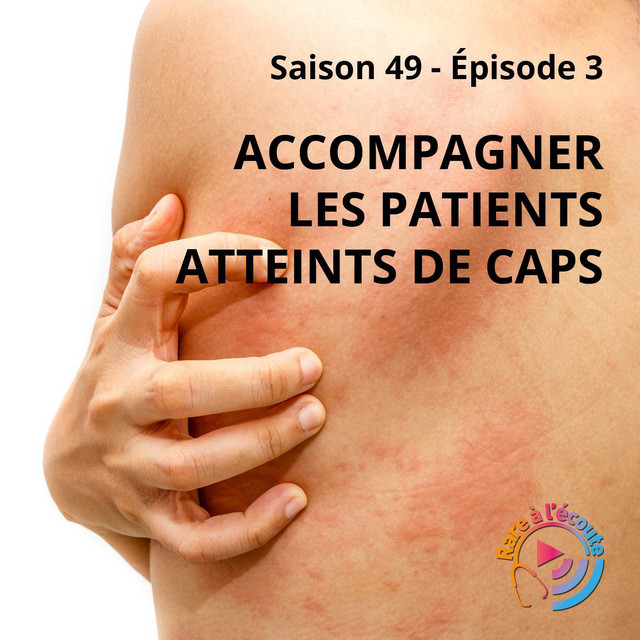 les patients atteints de CAPS RARE à l'écoute Podcast