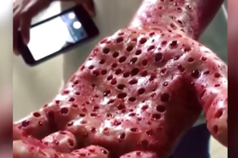 Video Worms That Belong In Nightmares Could Be Feeding On