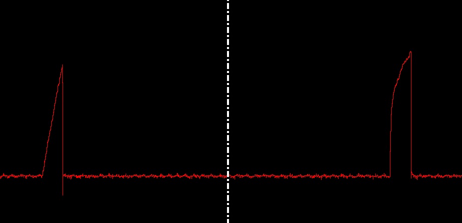 P0300, P0302, P0303 on 2003 Honda Civic 1.7 - Motor Vehicle Maintenance