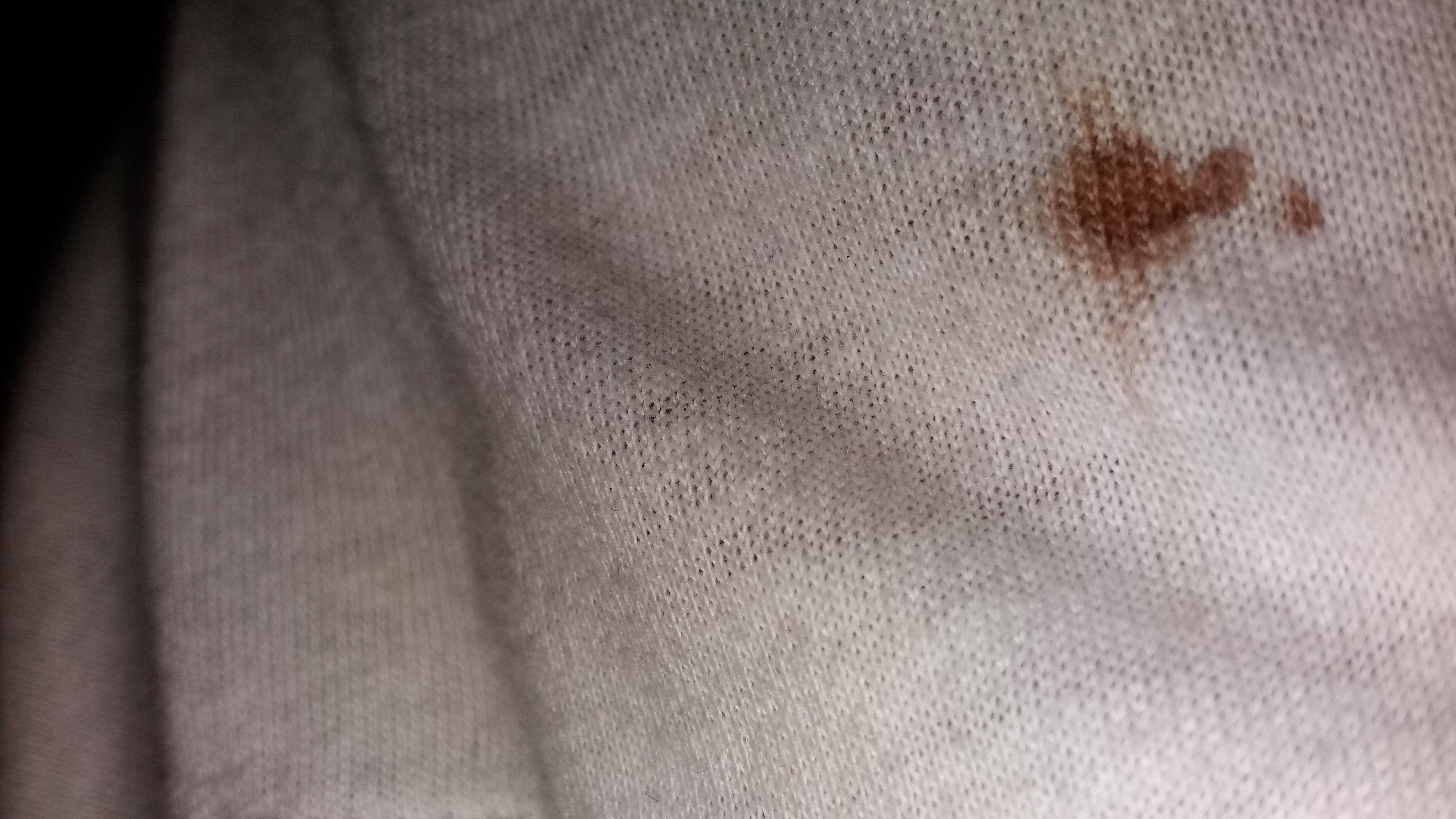 organic chemistry Why does blood turn reddish brown? Chemistry