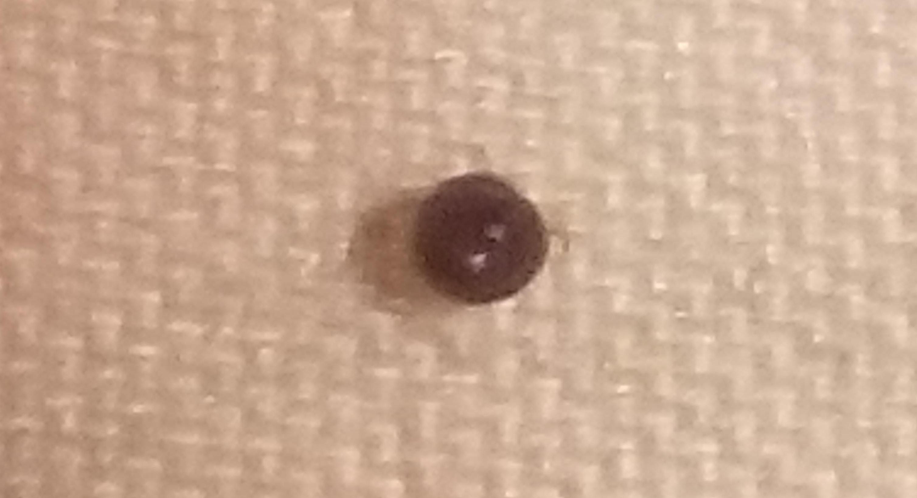 united states What is this tiny round shiny black bug that bites? The Great Outdoors Stack