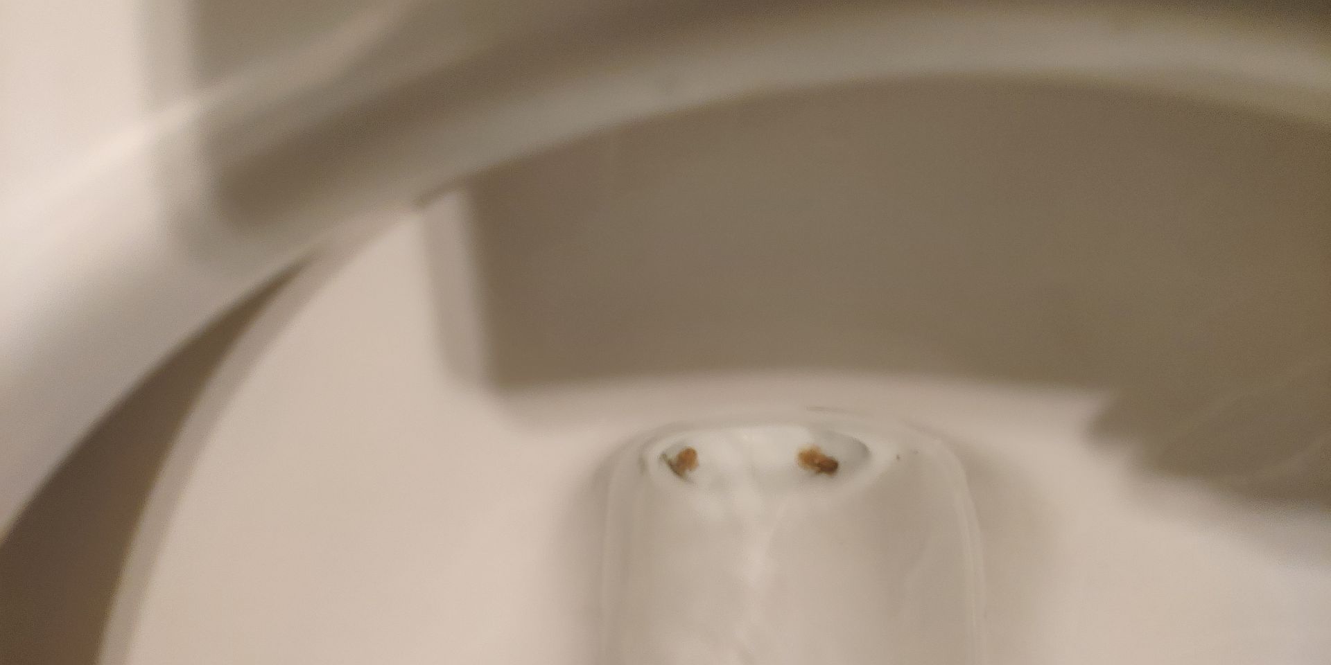 What Has Caused Odd Spots in Toilet Bowl Home Improvement Stack Exchange