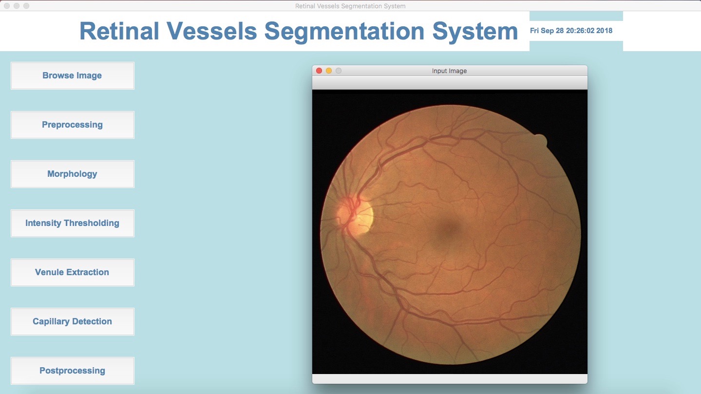 Python - How To Display Multiple Images Inside Tkinter Window? - Stack Overflow