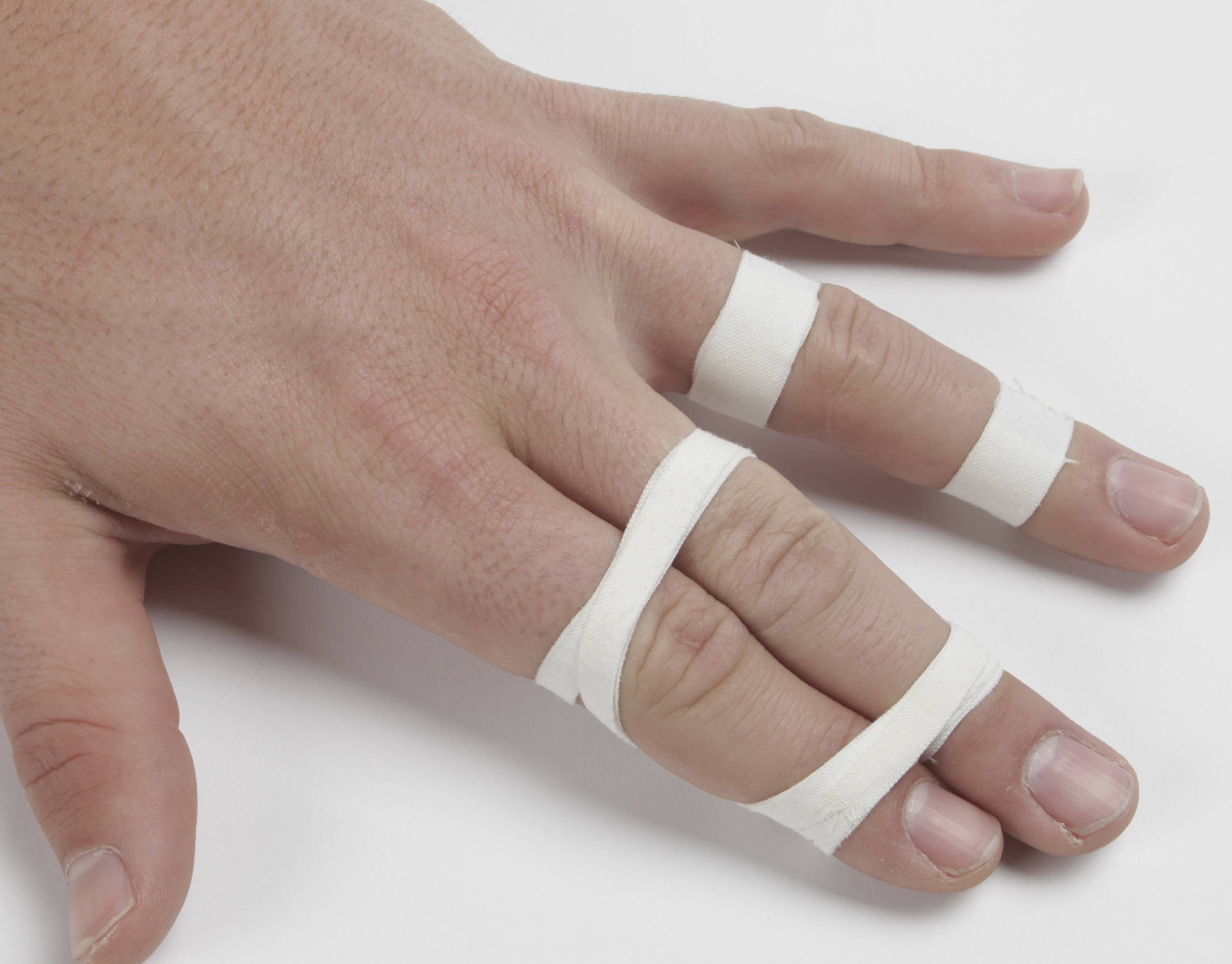 brazilian jiu jitsu How do you prevent/mitigate finger injuries in