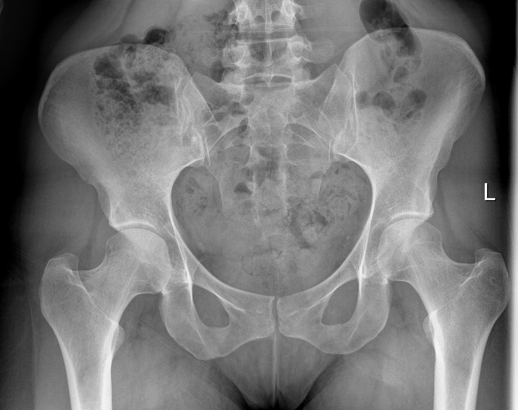diagnostics What might be the cause of this unexplained