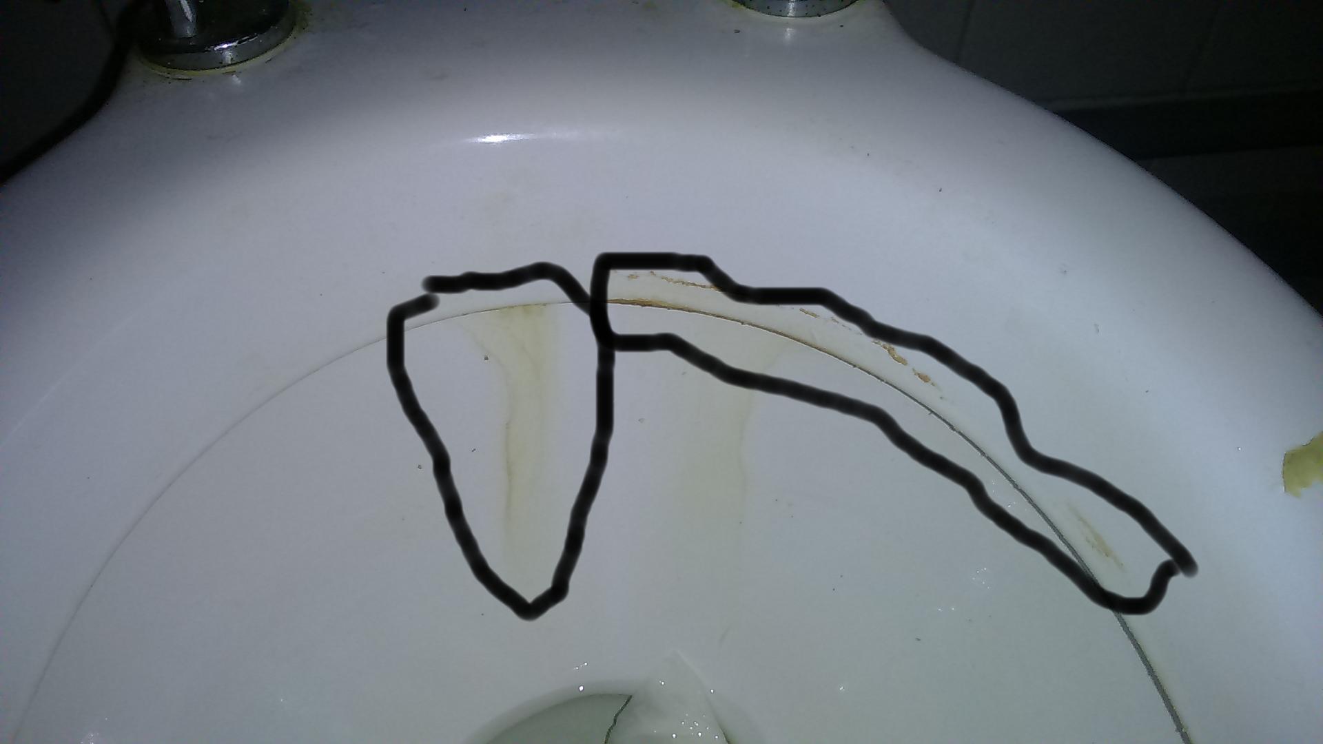 Remove yellow stains on toilet Love & Improve Life