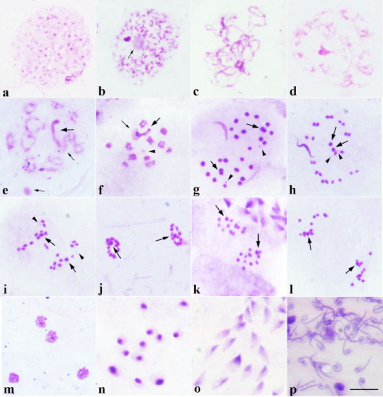 microscopy How do I identify the different stages of meiosis under