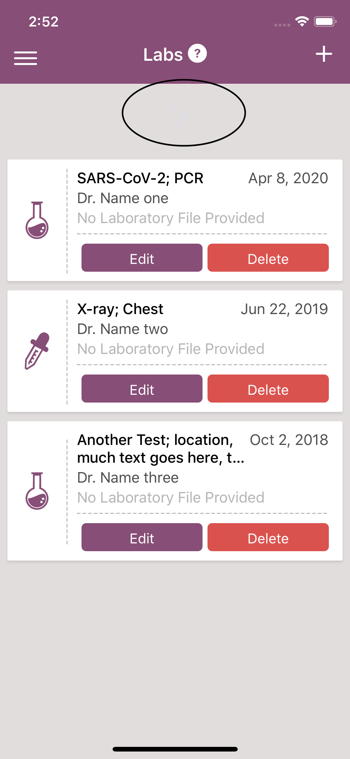 ios13 React Native FlatList Loading Indicator not