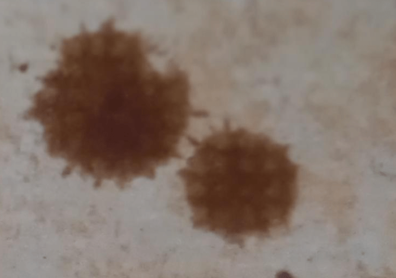 fluid dynamics Why do puddles of coffee sludge have spikes over its