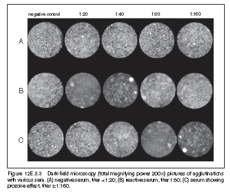 What is the principle behind Microagglutination test (MAT)? ECHEMI