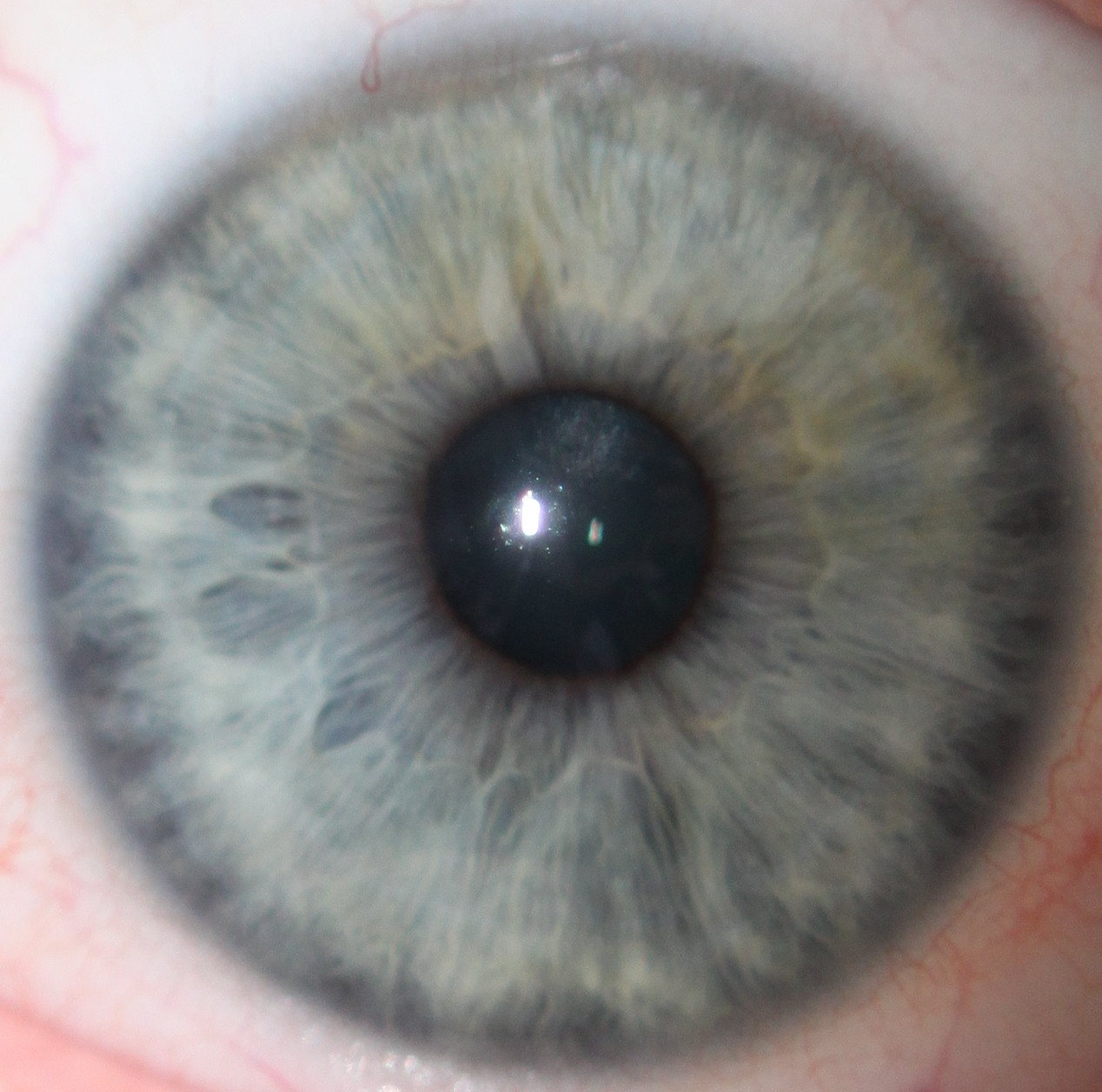 How do I find the absolute color of someone's eyes in a photograph