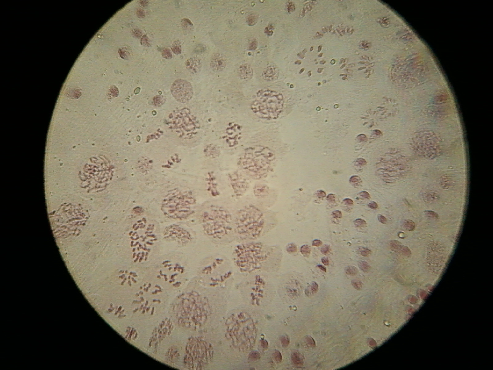 microscopy How do I identify the different stages of meiosis under