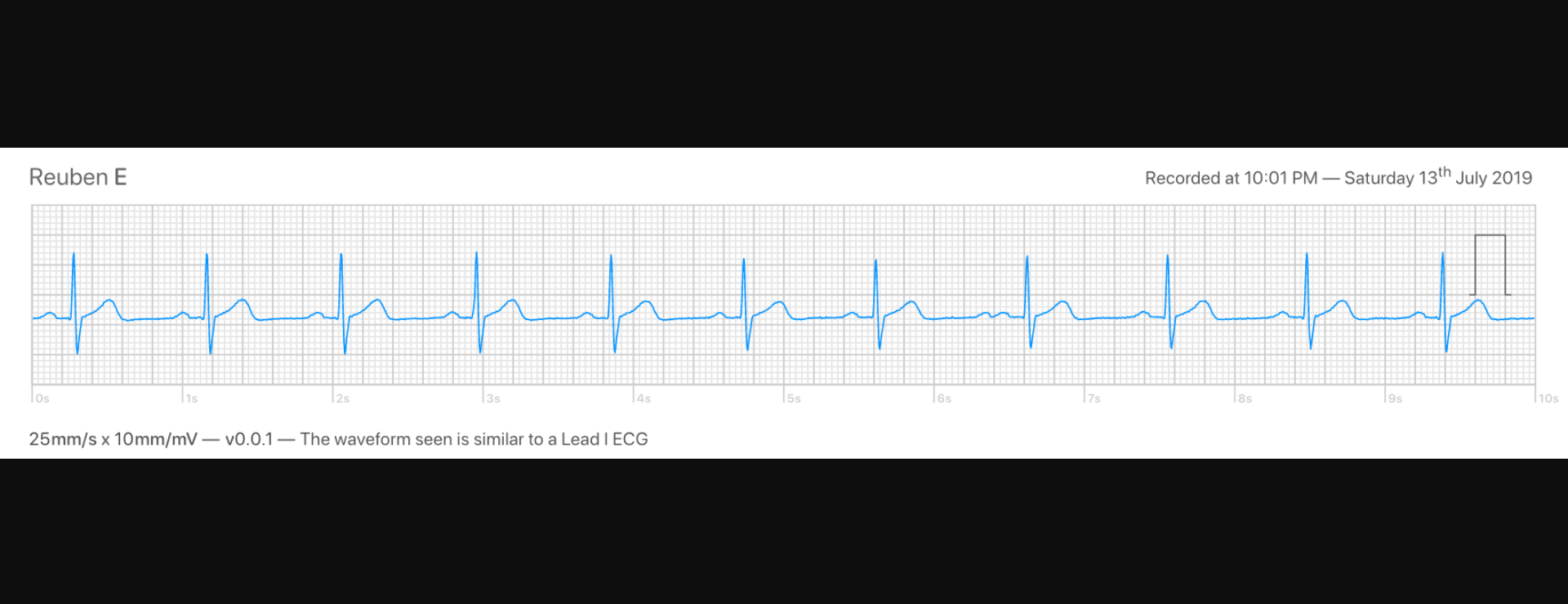 reactjs Creating ECG Boxes in [REACT/VISX] Stack Overflow