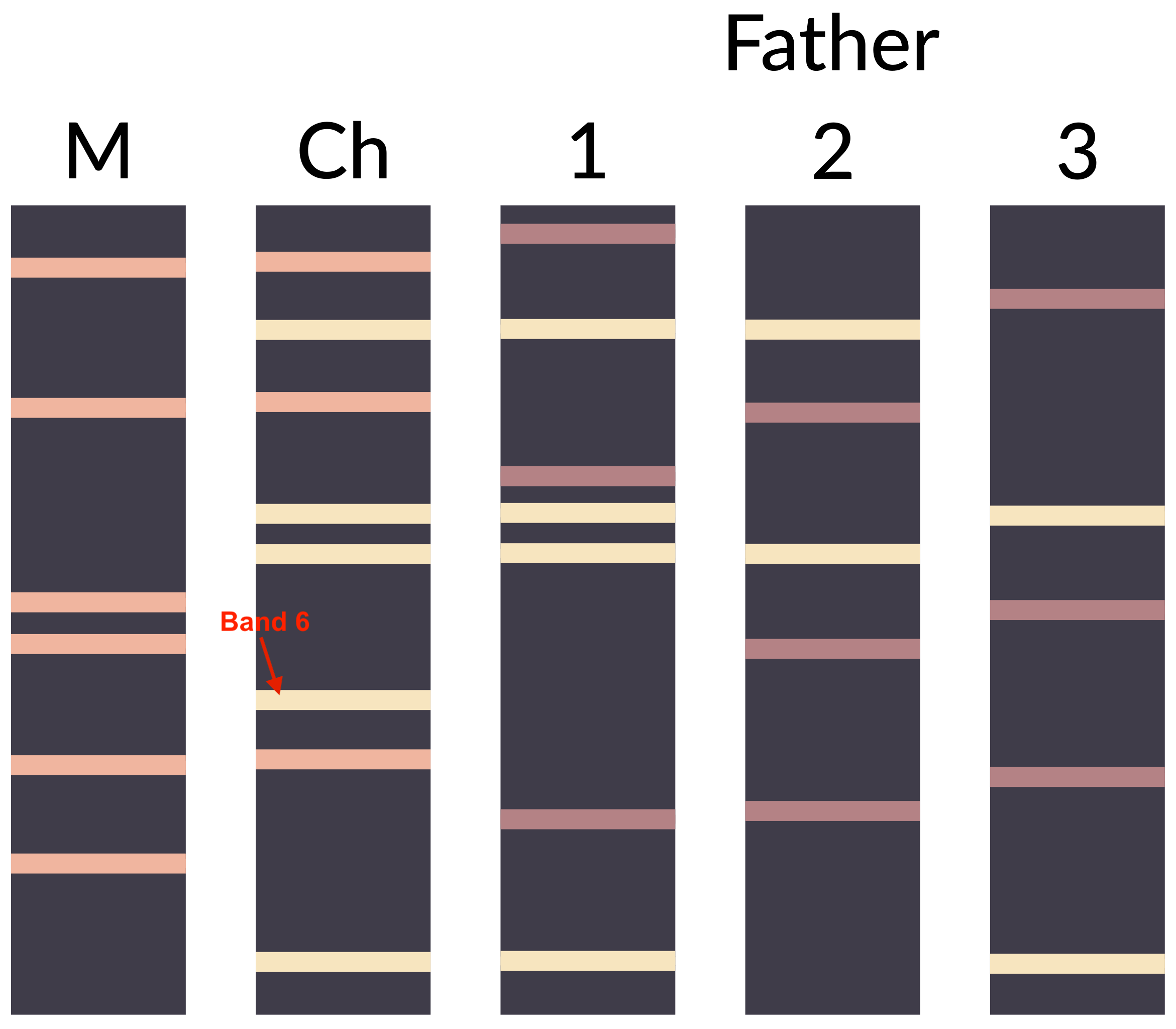 homework Paternity testing using gel electrophoresis Biology Stack