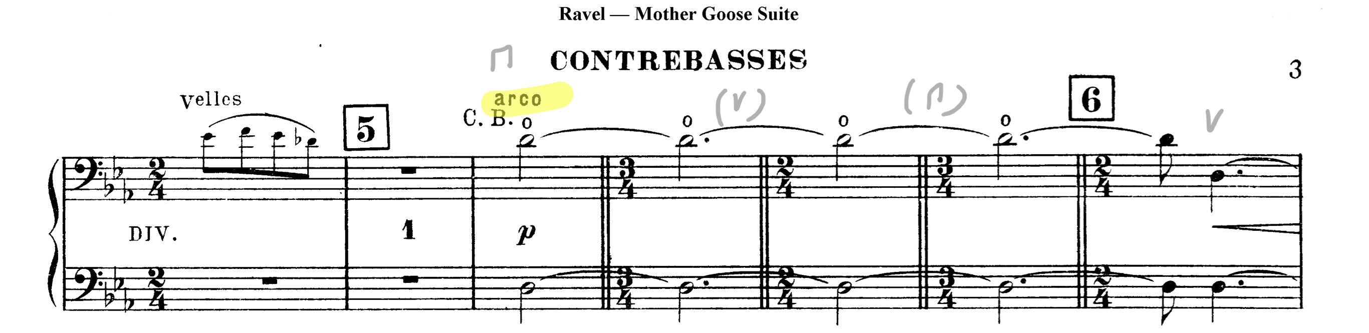 notation What does a diamond note head mean in a bass part when it’s