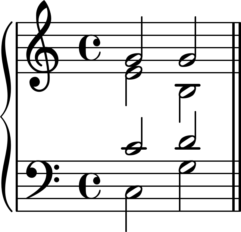 theory Voice crossings and voice leading measures Music Practice