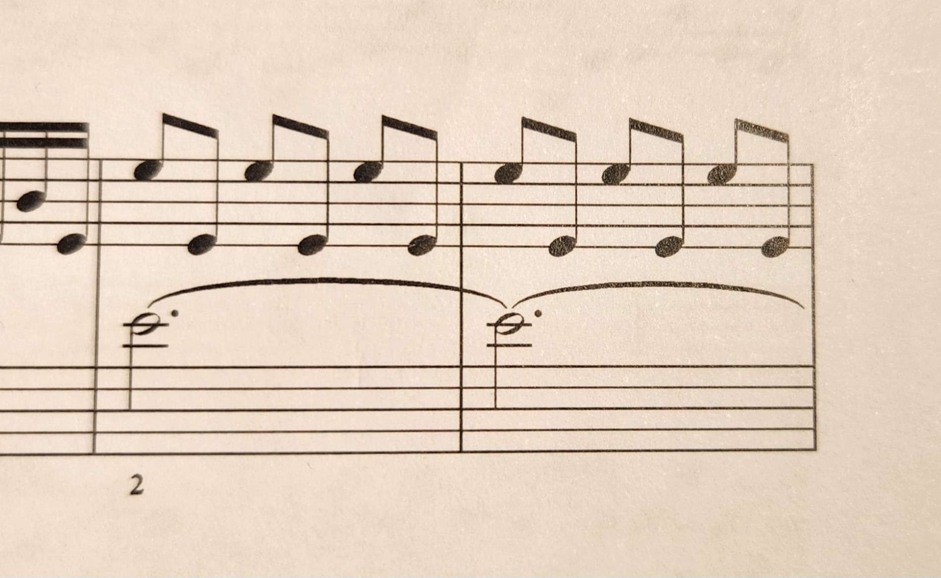 notation Same note on two staves in a piano score Music Practice