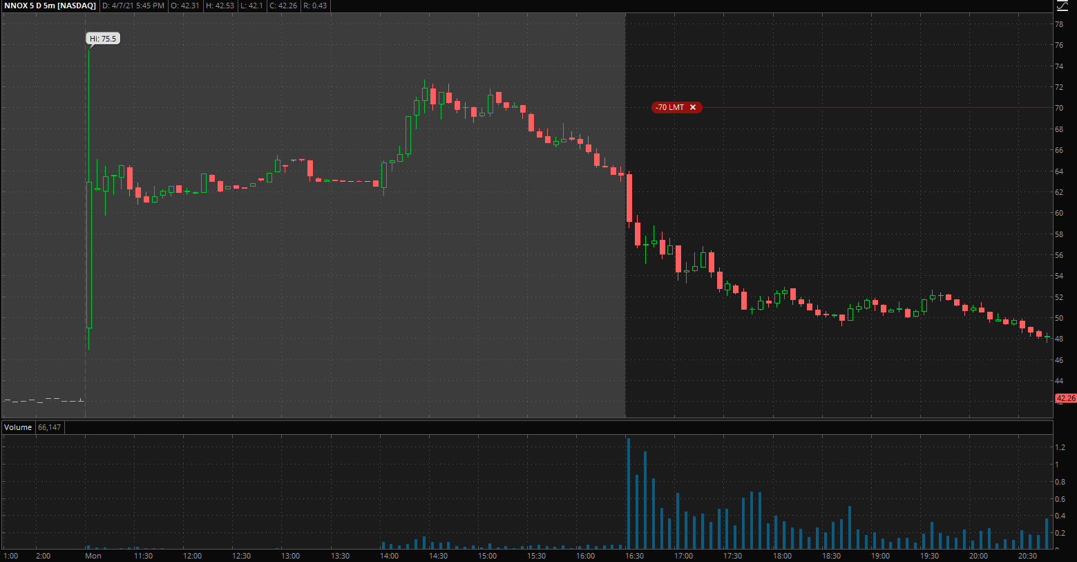news Practicalities of premarket trading Personal Finance & Money
